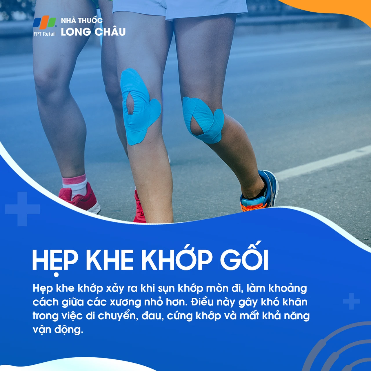 Hẹp khe khớp gối 1