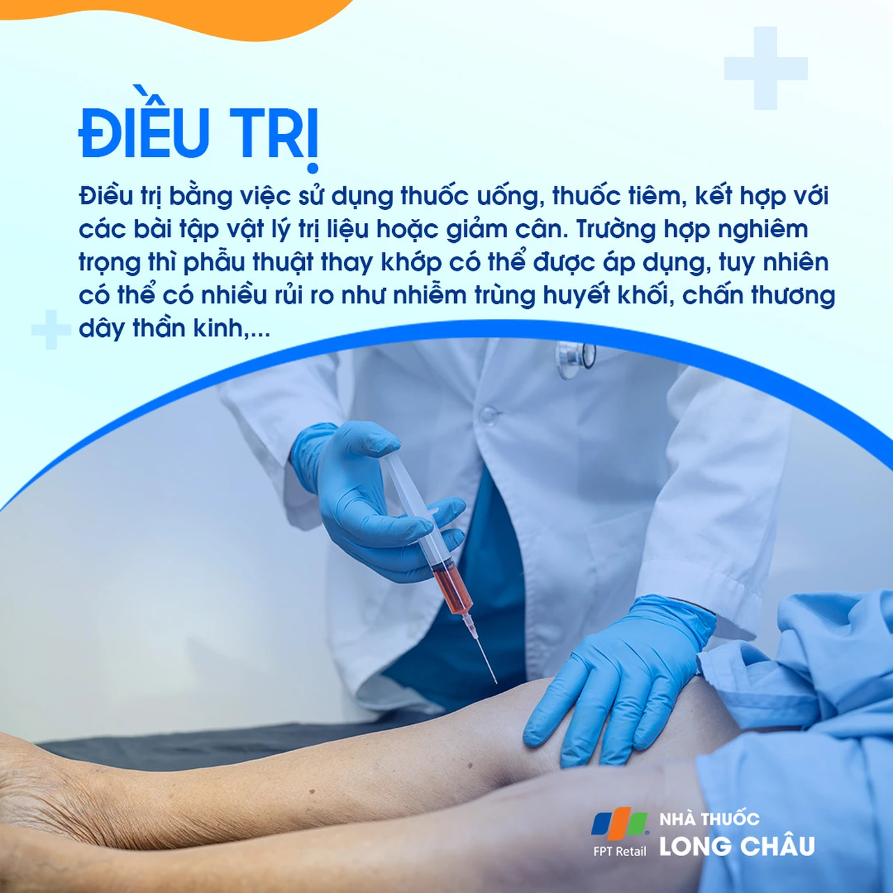 Hẹp khe khớp gối 6