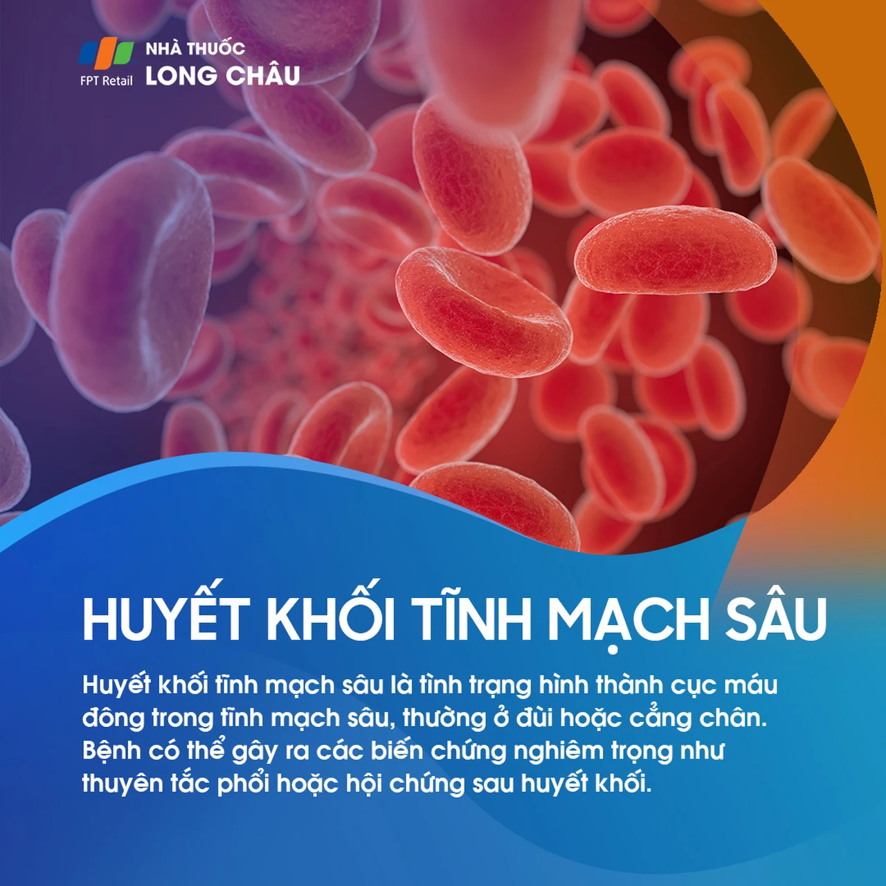 Huyết khối tĩnh mạch sâu 1