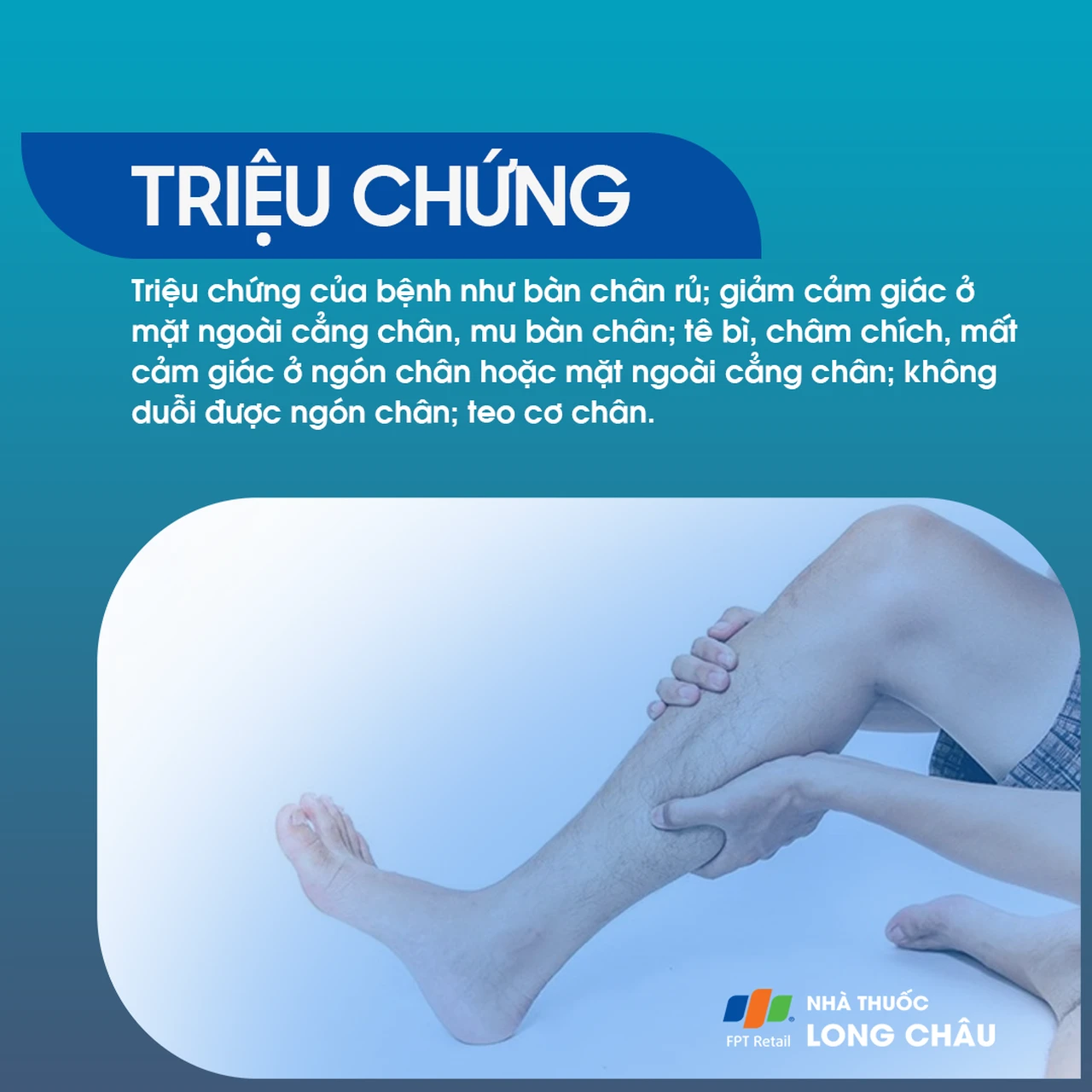 Liệt dây thần kinh hông khoeo ngoài 2