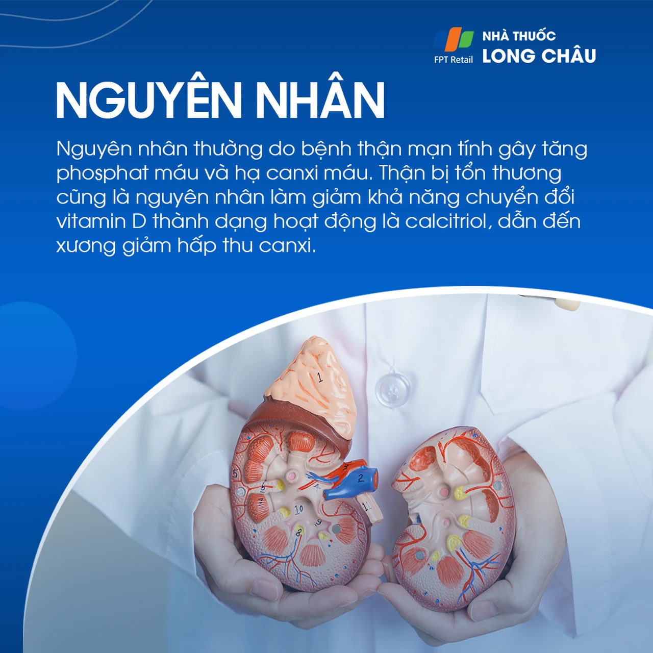Loạn dưỡng xương 4