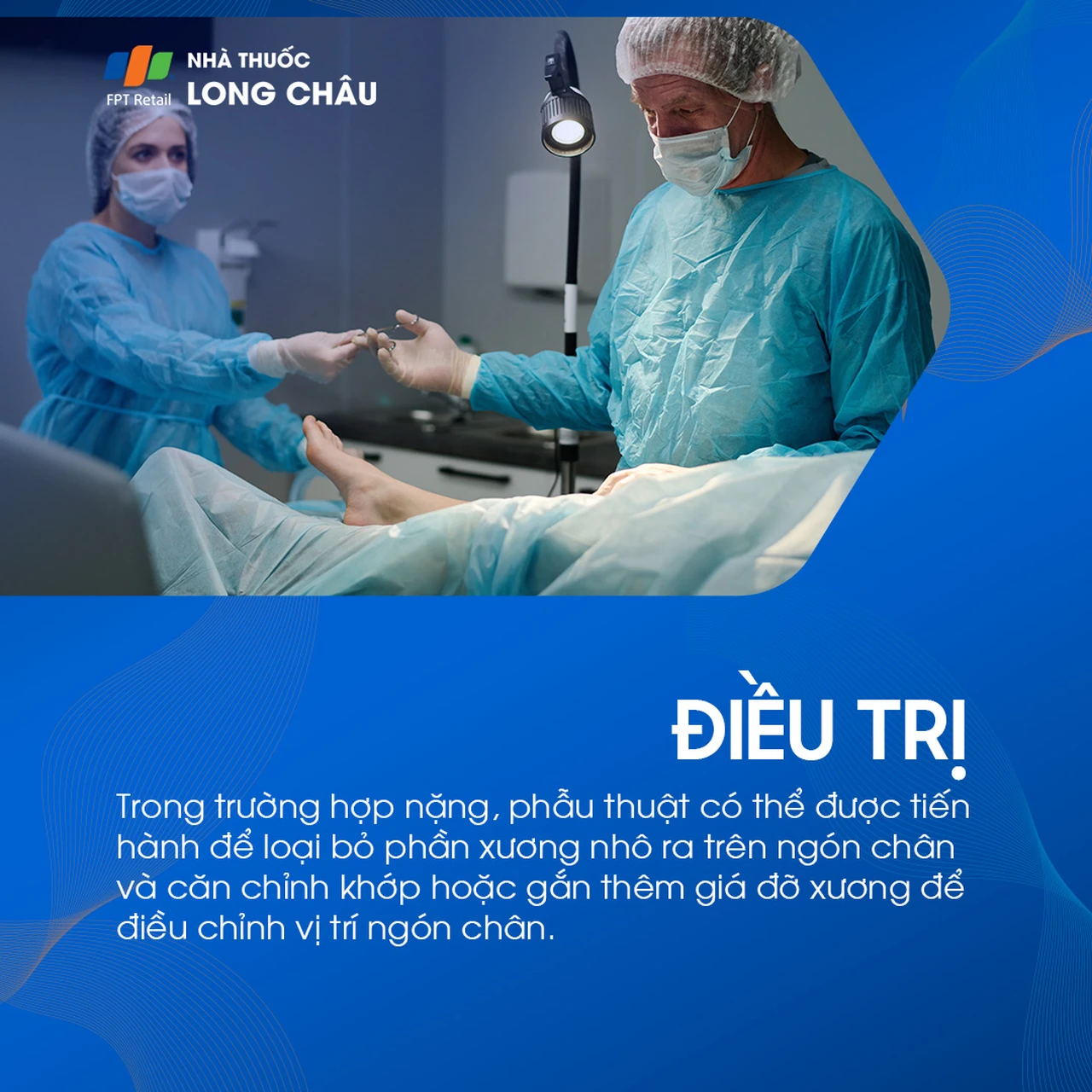 Ngón chân hình búa 7