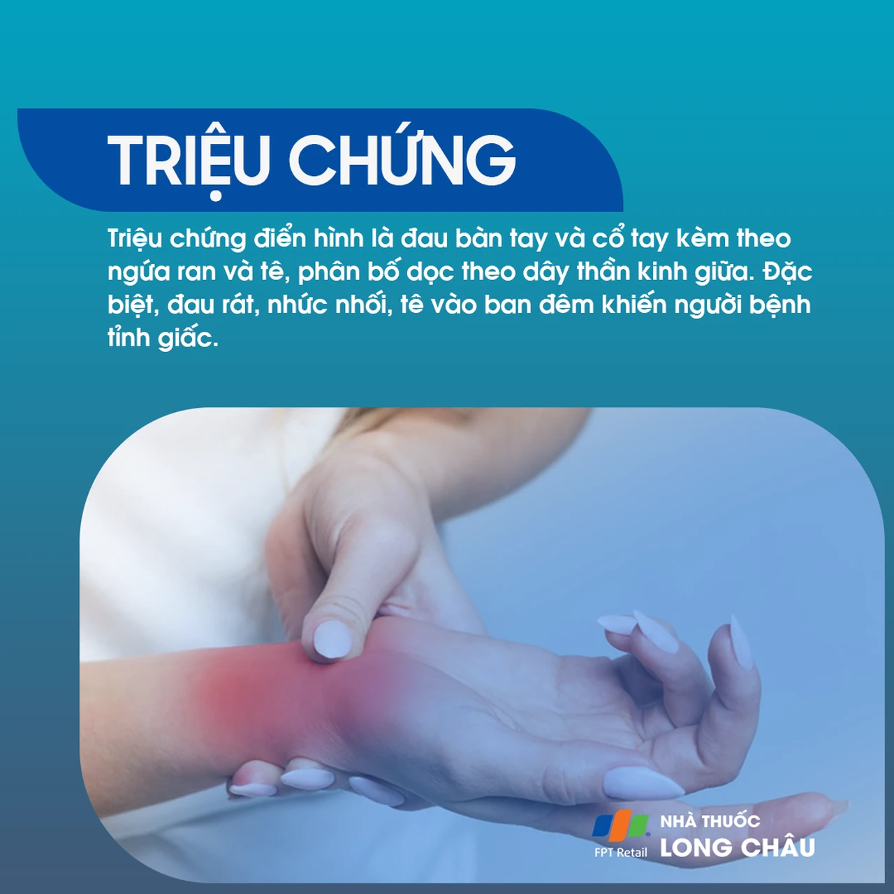 Hội chứng ống cổ tay 2