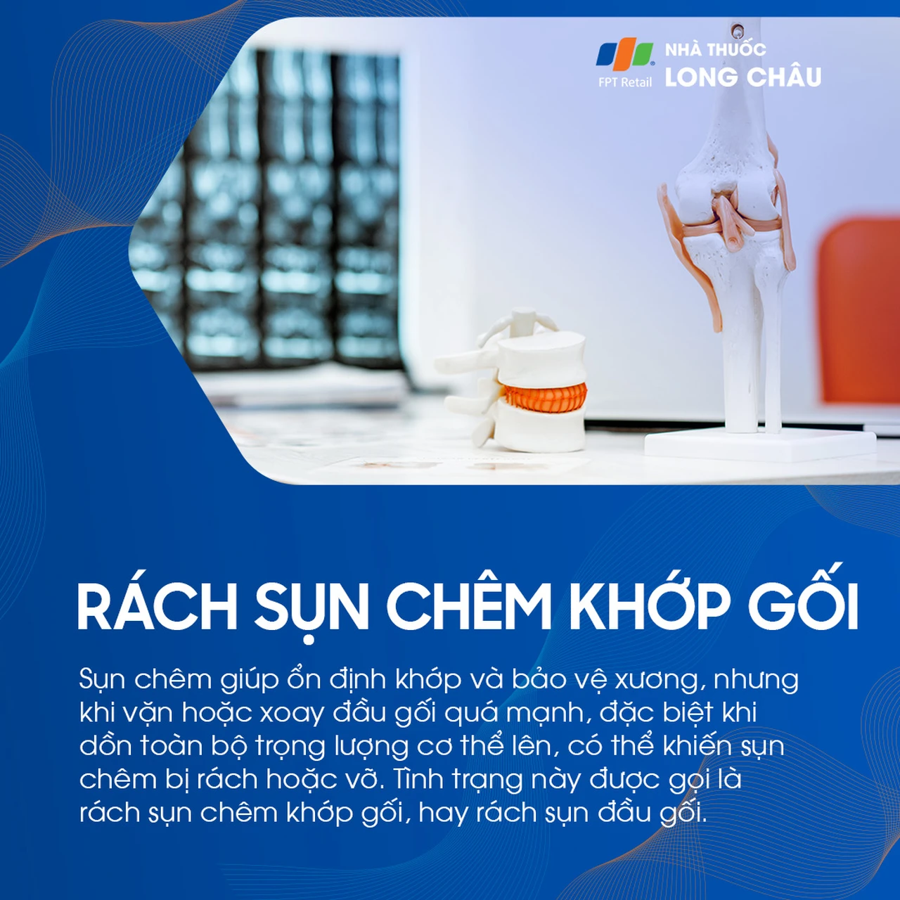 Rách sụn chêm khớp gối 1
