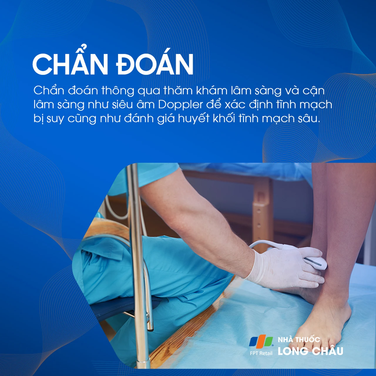 Suy giãn tĩnh mạch chi dưới 6