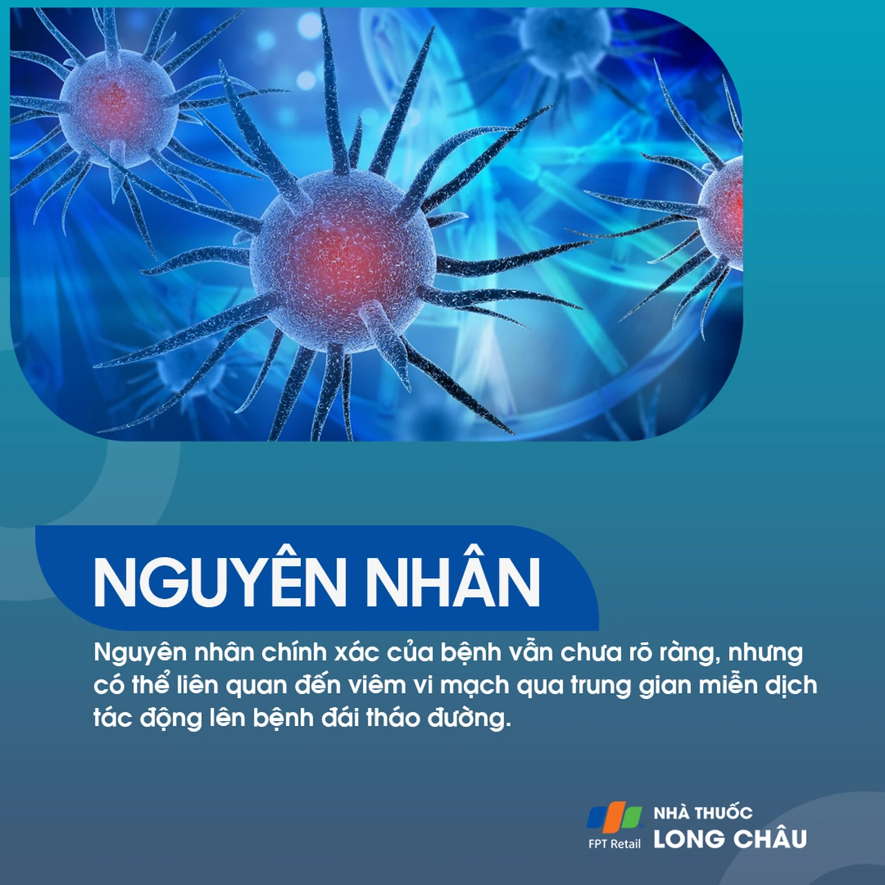 Teo cơ do đái tháo đường 4