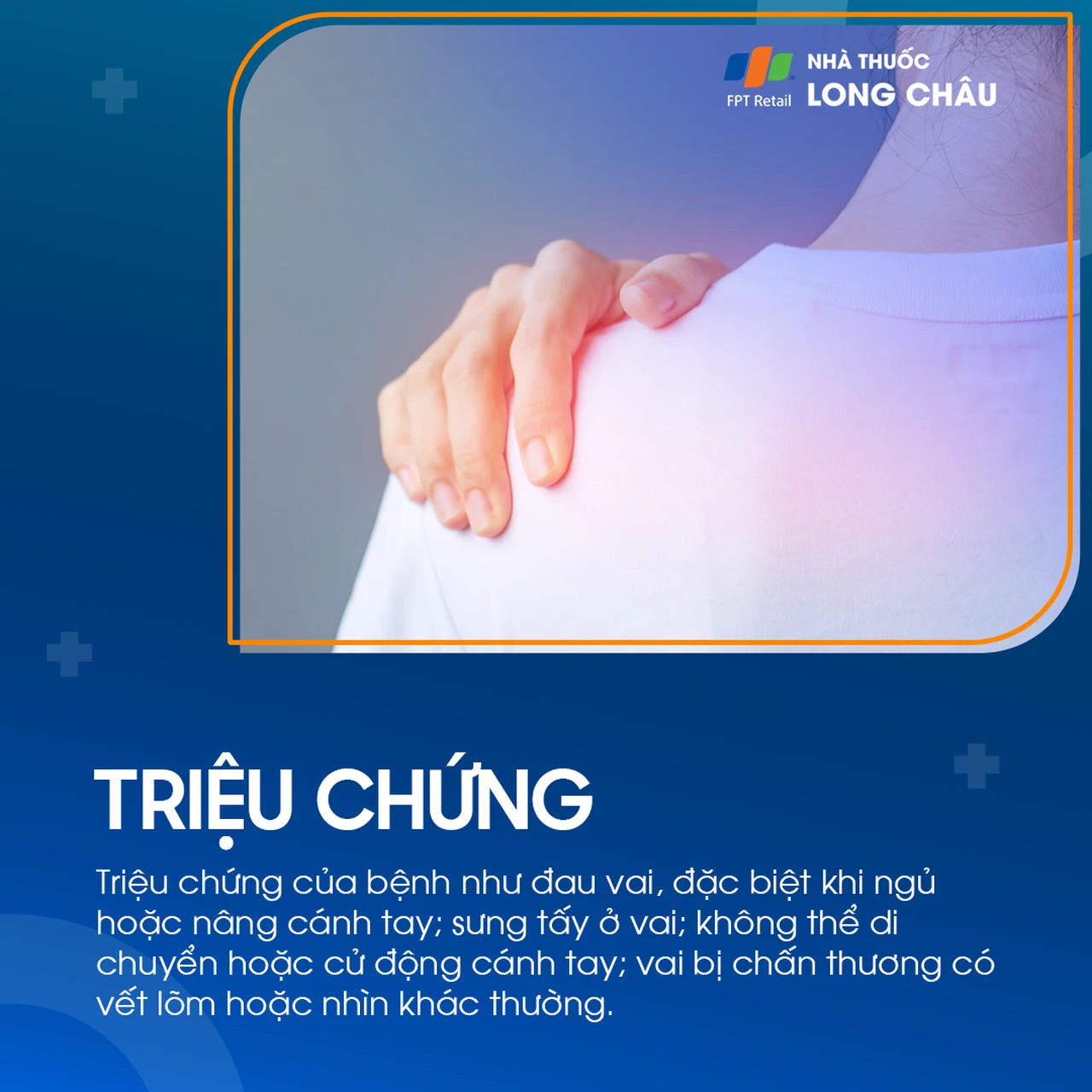 Trật khớp cùng đòn 2