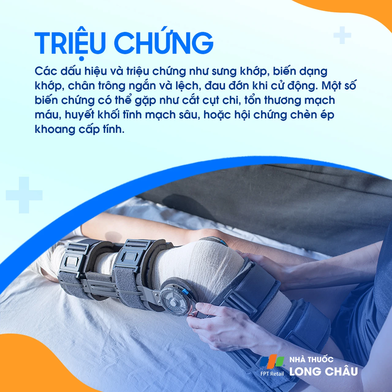 Trật khớp gối 2