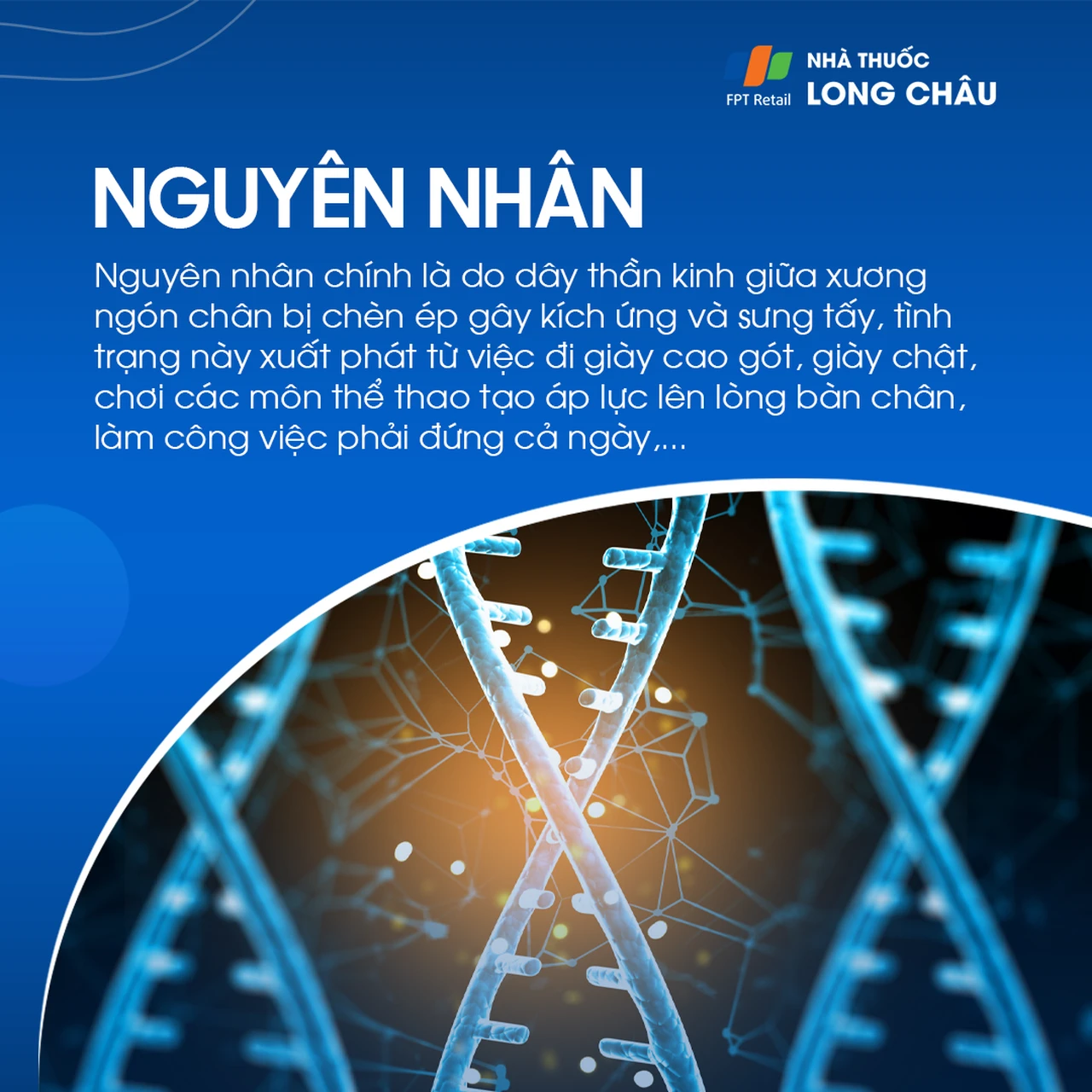 U dây thần kinh morton 3