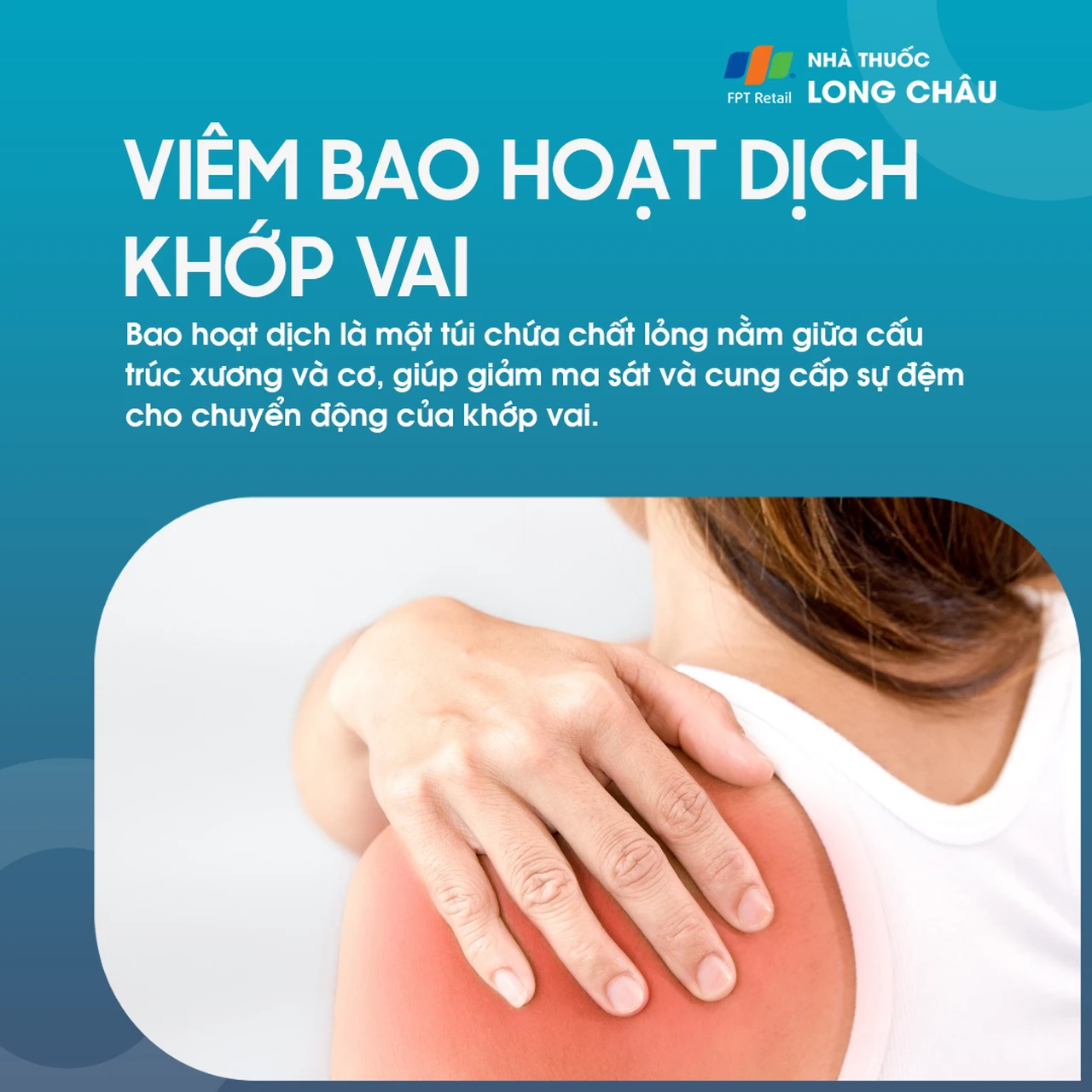 Viêm bao hoạt dịch khớp vai là gì