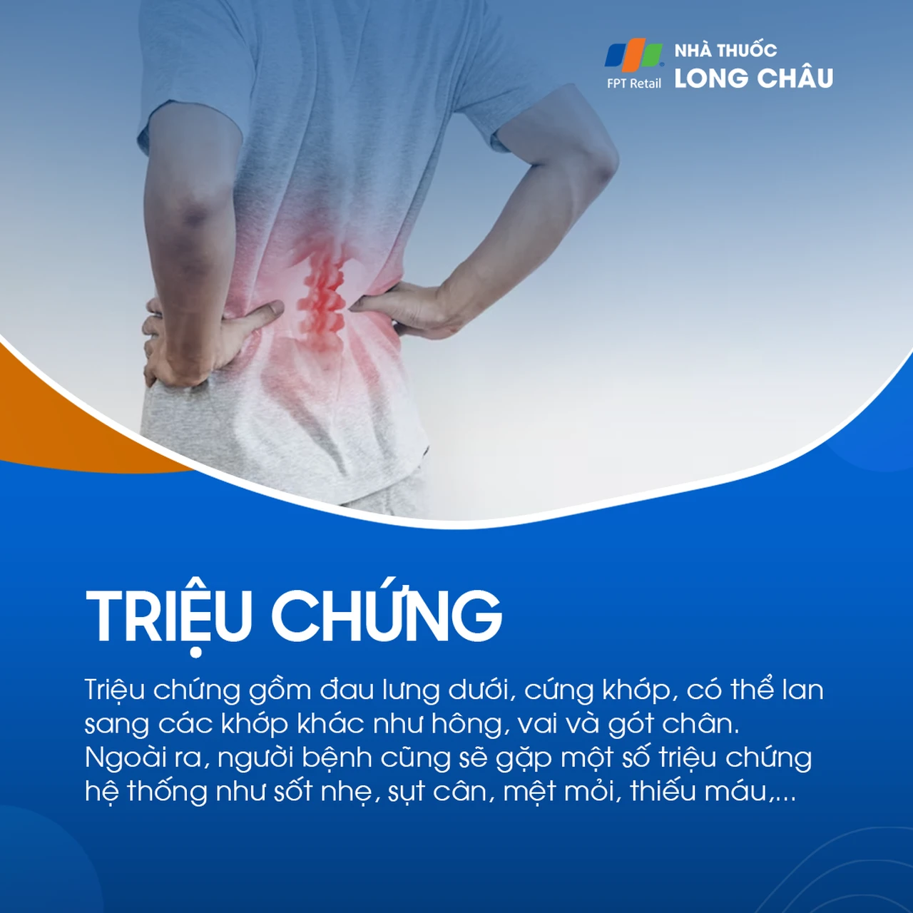 Viêm cột sống dính khớp 2