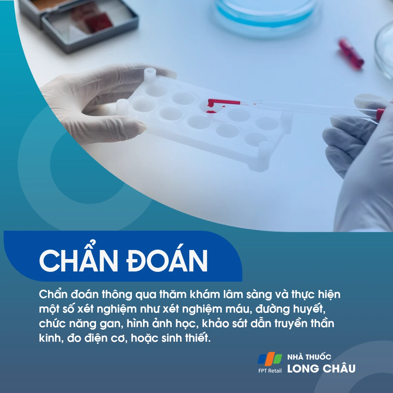 Viêm đa dây thần kinh 6