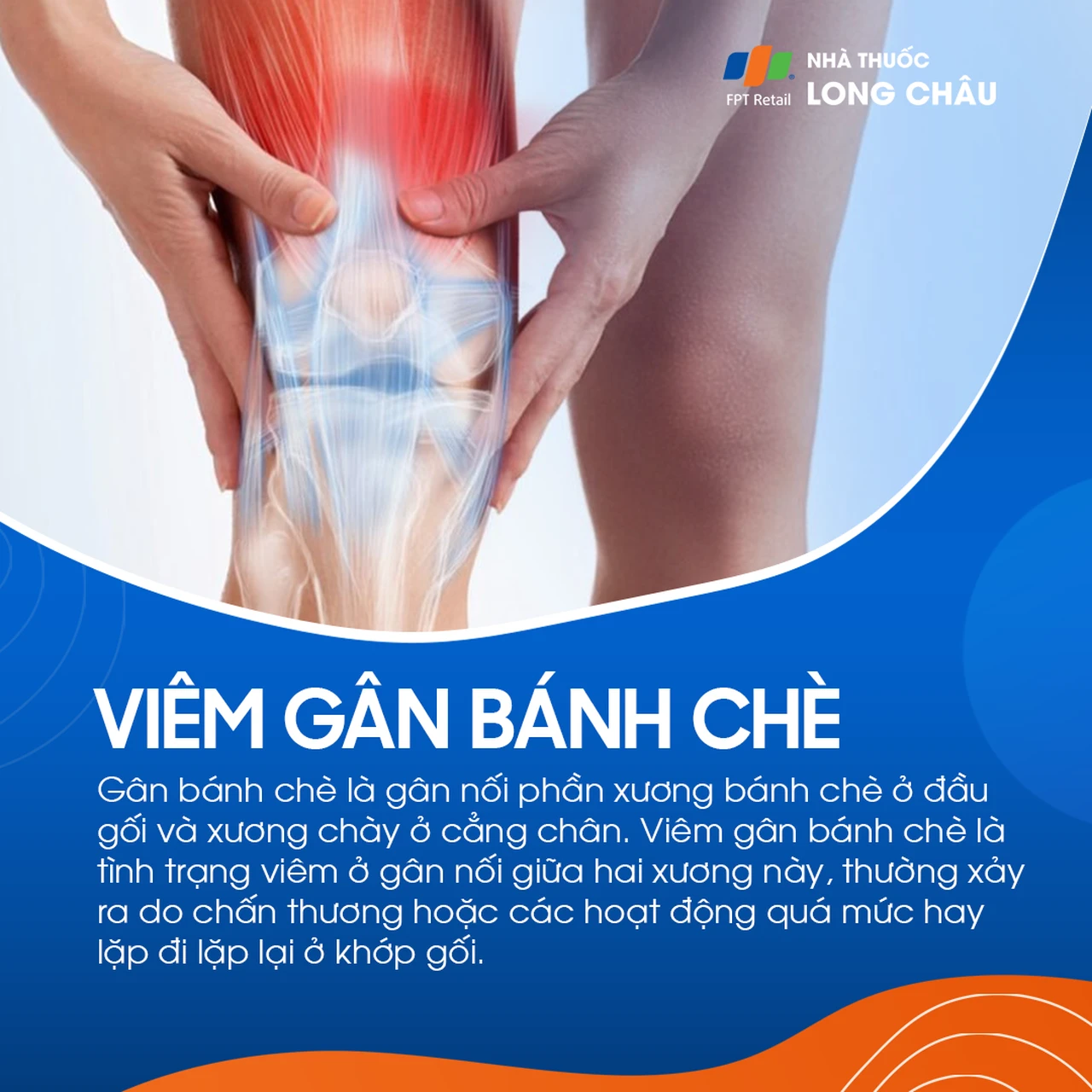 Viêm gân bánh chè 1