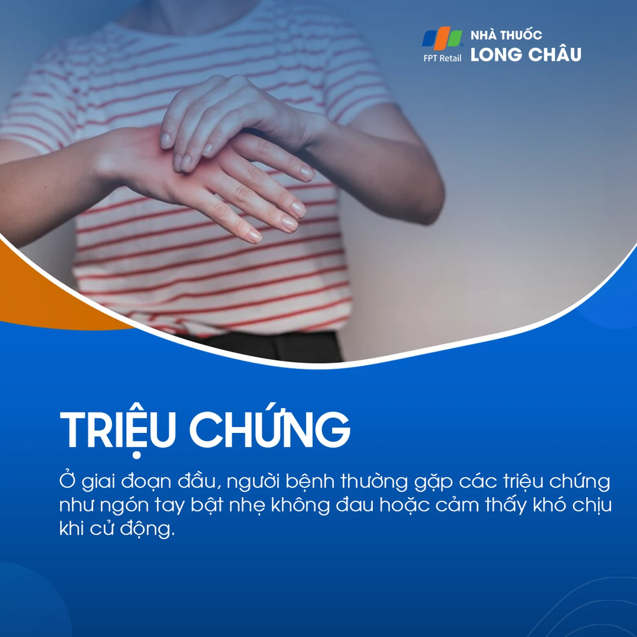 Viêm gân gấp ngón cái 3