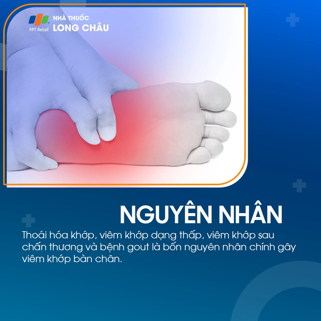 Viêm khớp bàn chân 4