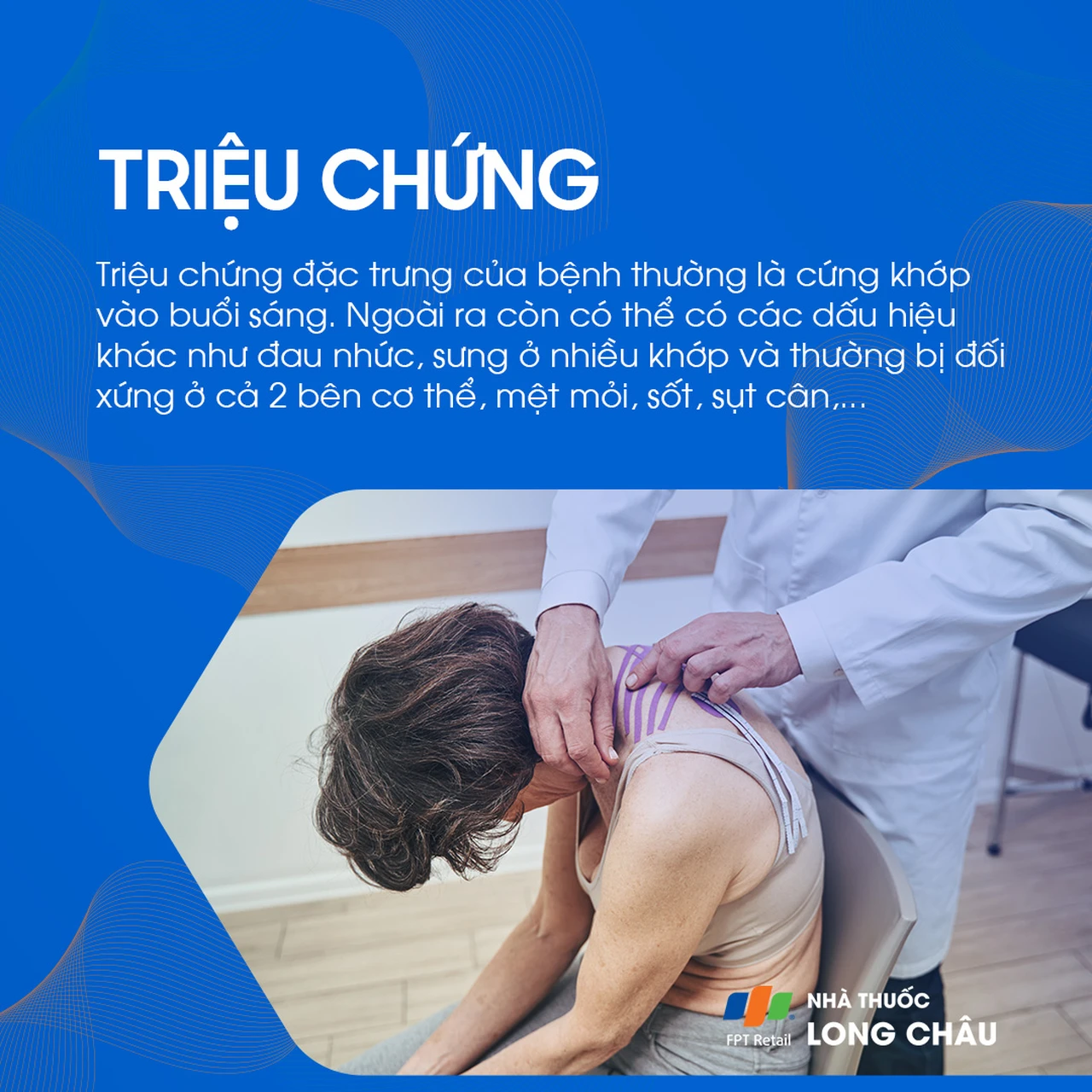 Viêm đa khớp dạng thấp 2