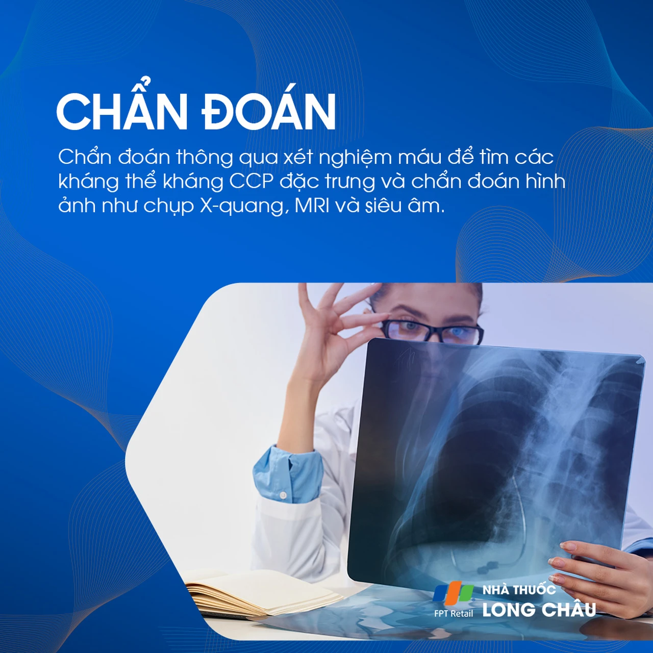 Viêm khớp dạng thấp 6