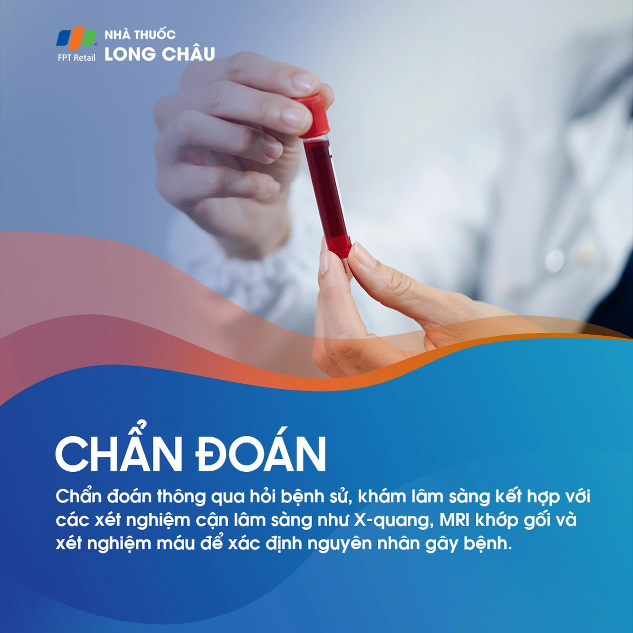 Viêm khớp gối 5