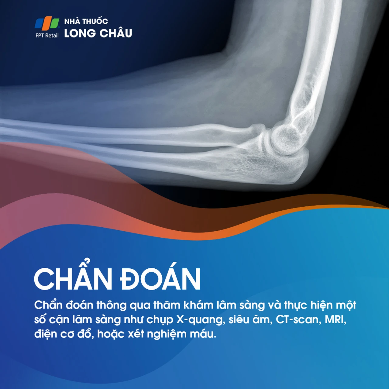 Viêm khớp khuỷu tay 5