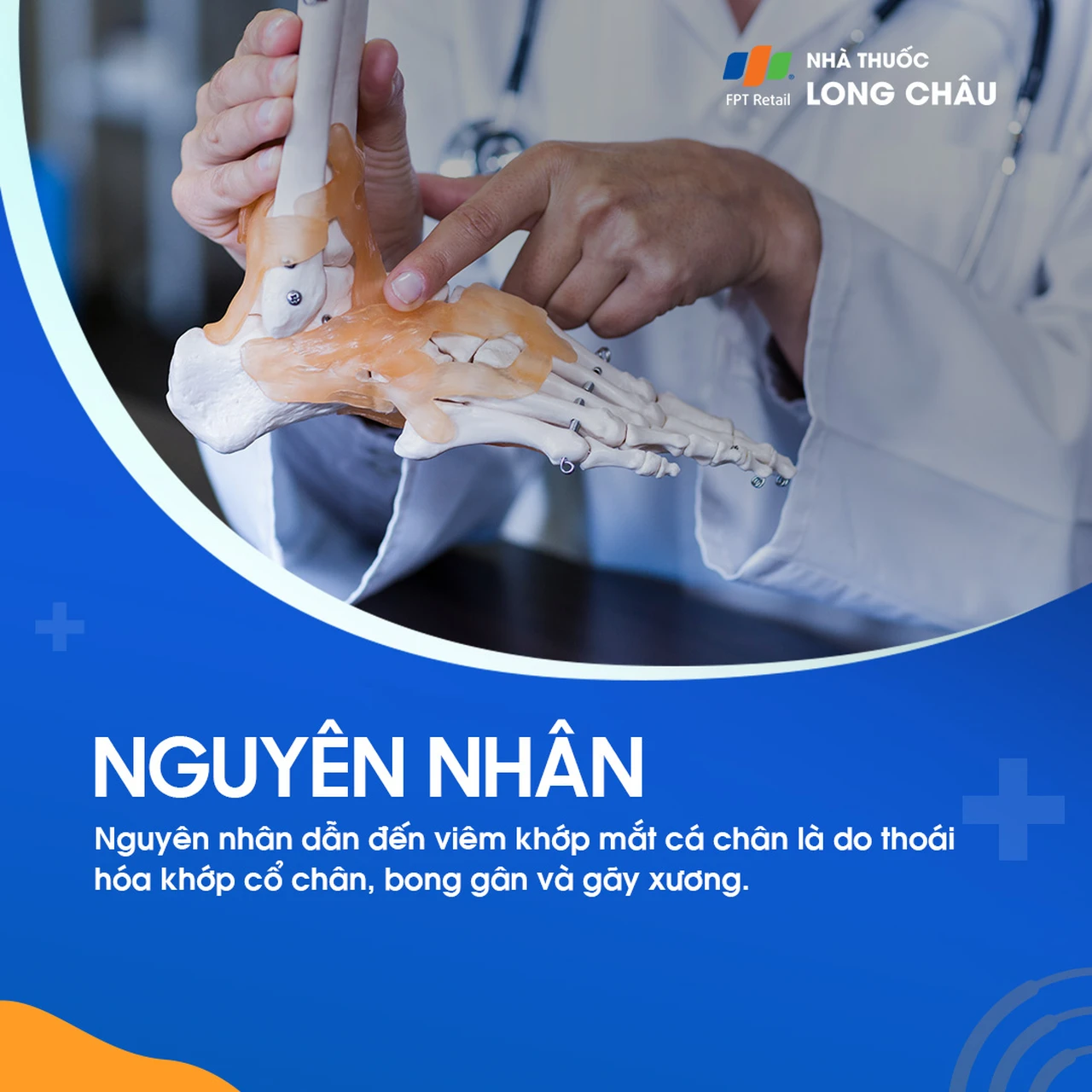 Viêm khớp mắt cá chân 4