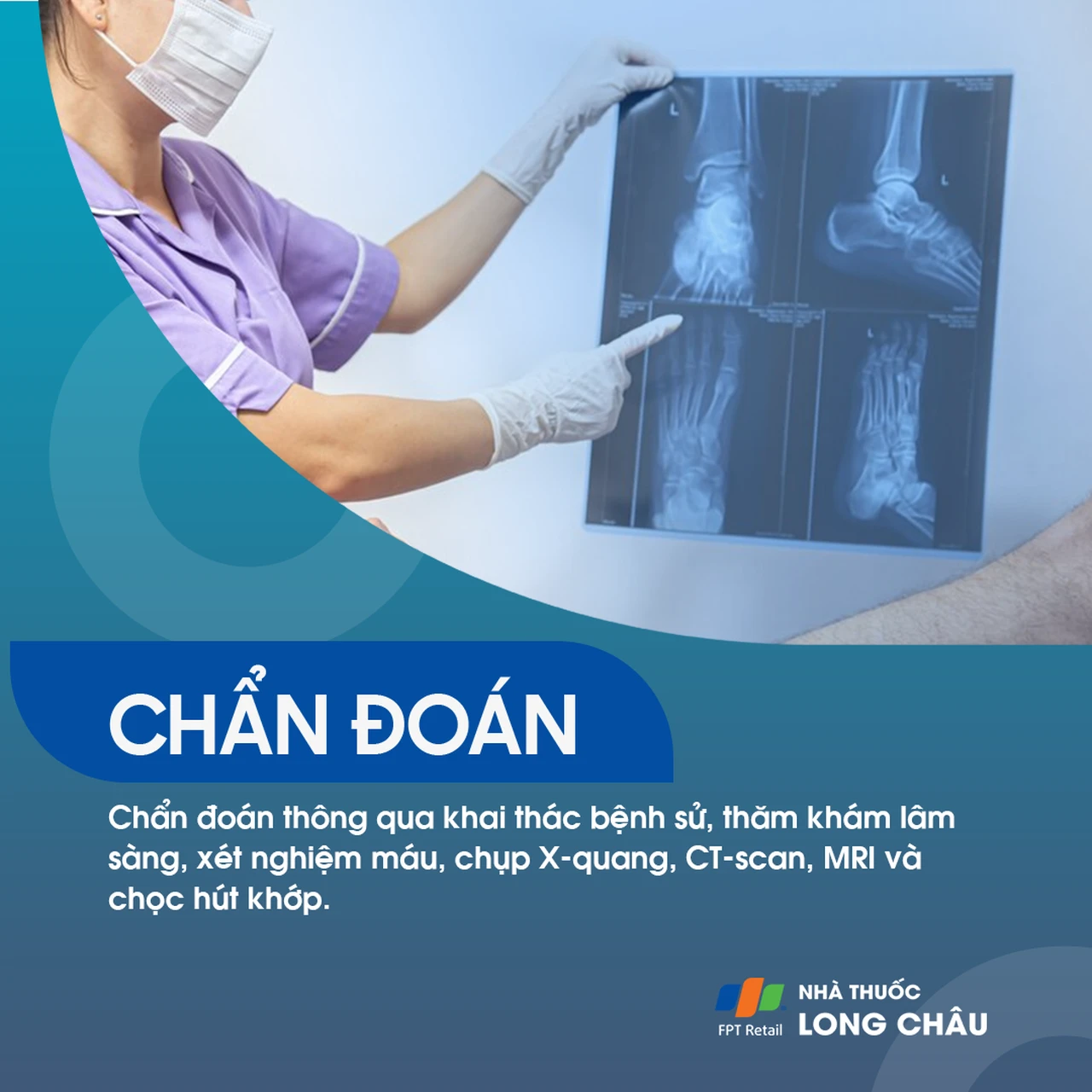 Viêm khớp ngón chân 5
