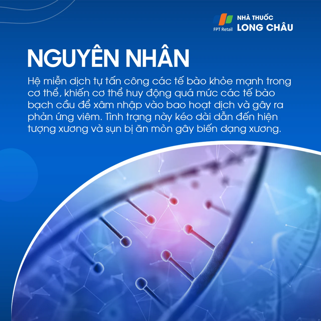 Viêm khớp tự miễn 4