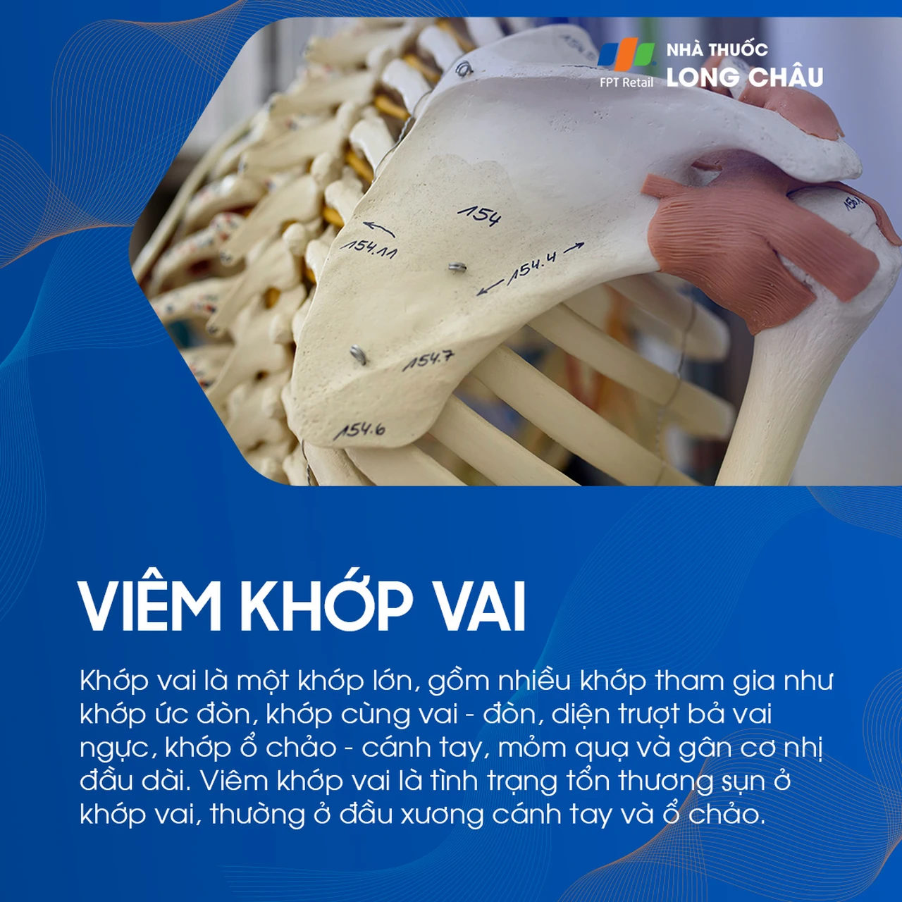 Viêm khớp vai 1