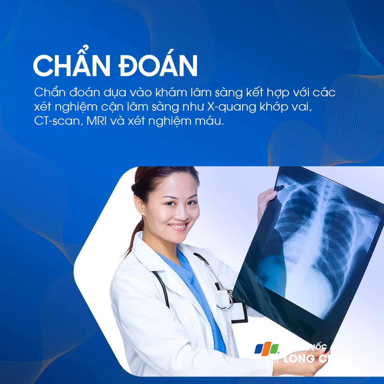 Viêm khớp vai 6