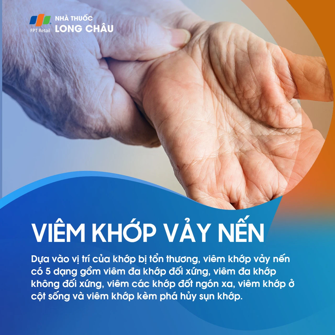 Viêm khớp vảy nến 2