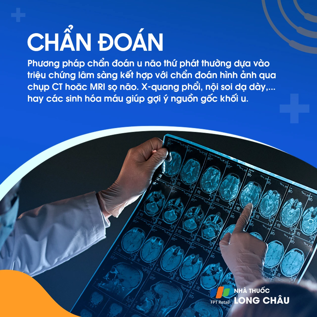 U não thứ phát 6