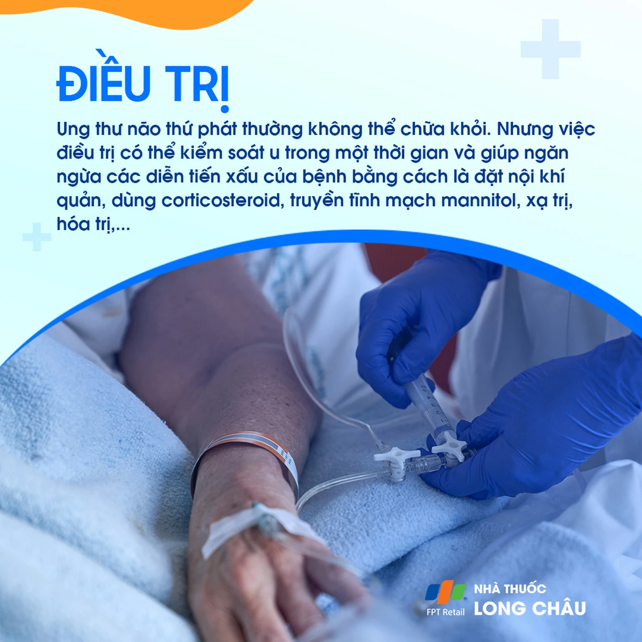 U não thứ phát 7