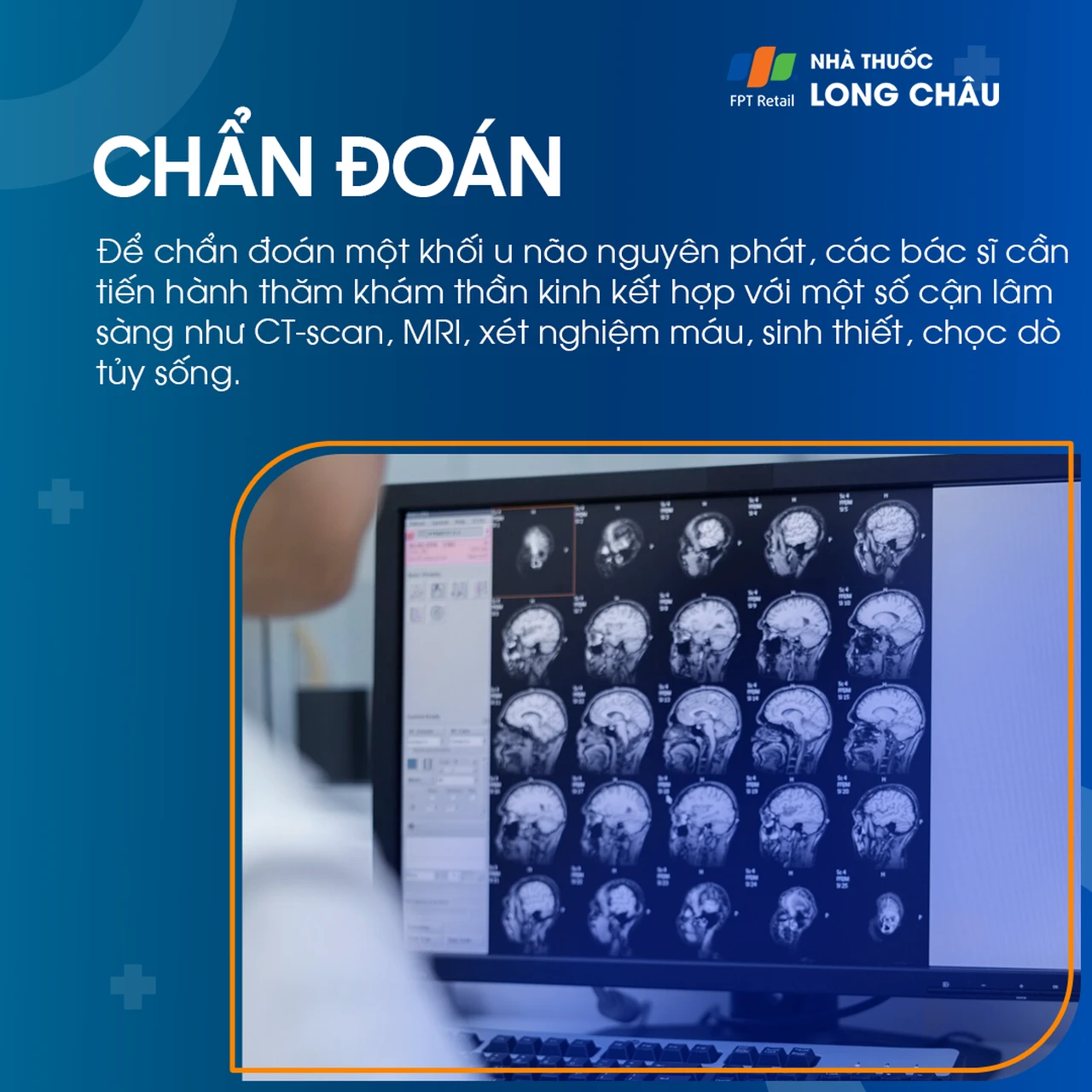 U não nguyên phát 5