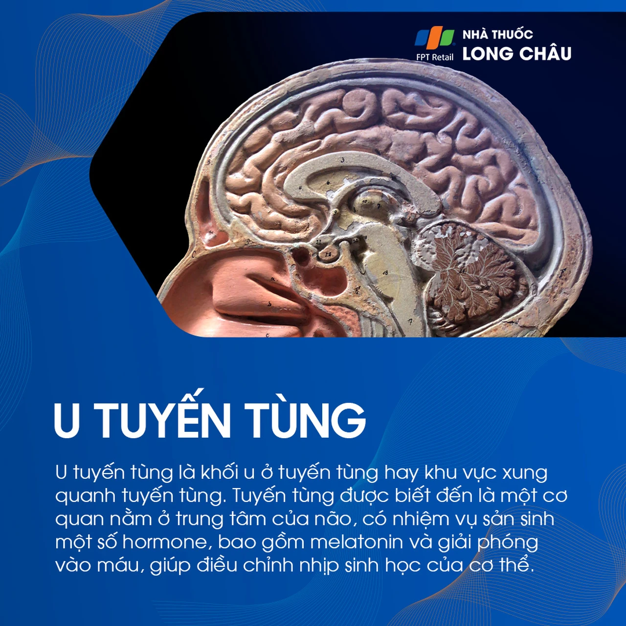 U tuyến tùng 1