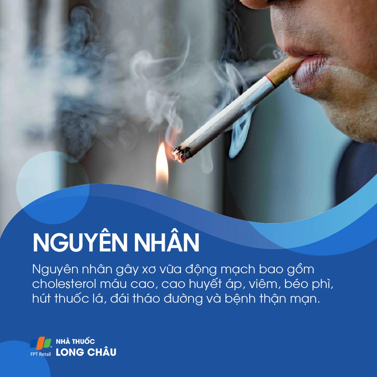 Xơ vữa động mạch 2