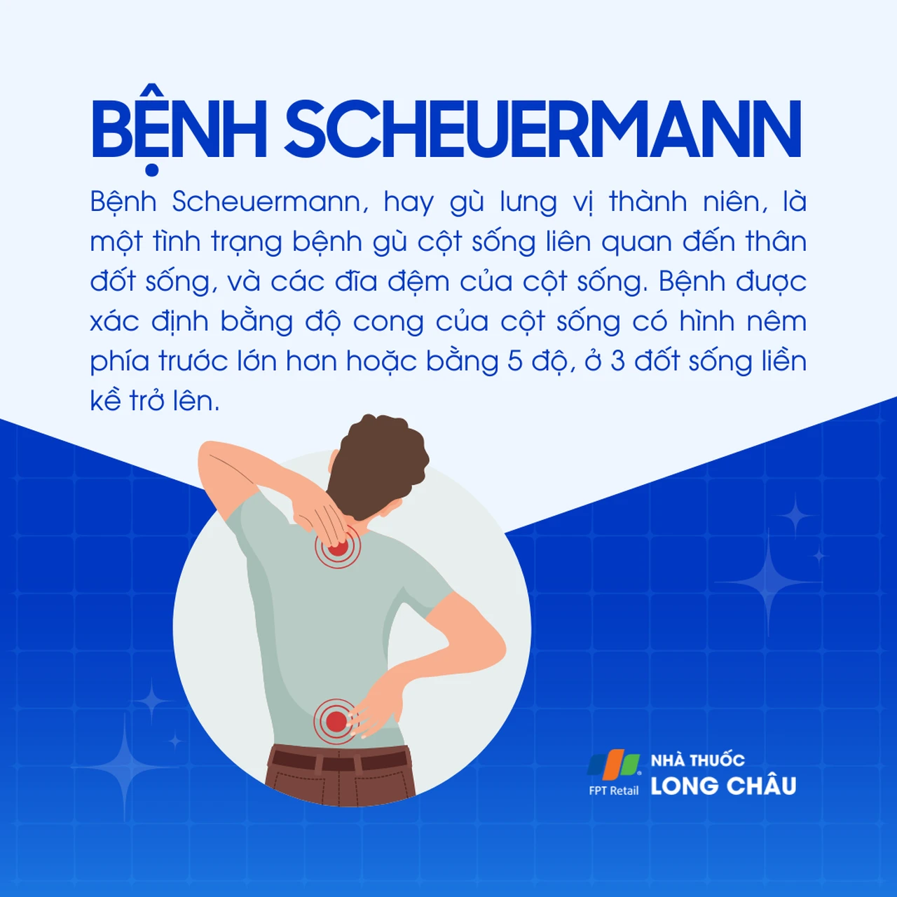 Bệnh Scheuermann 1