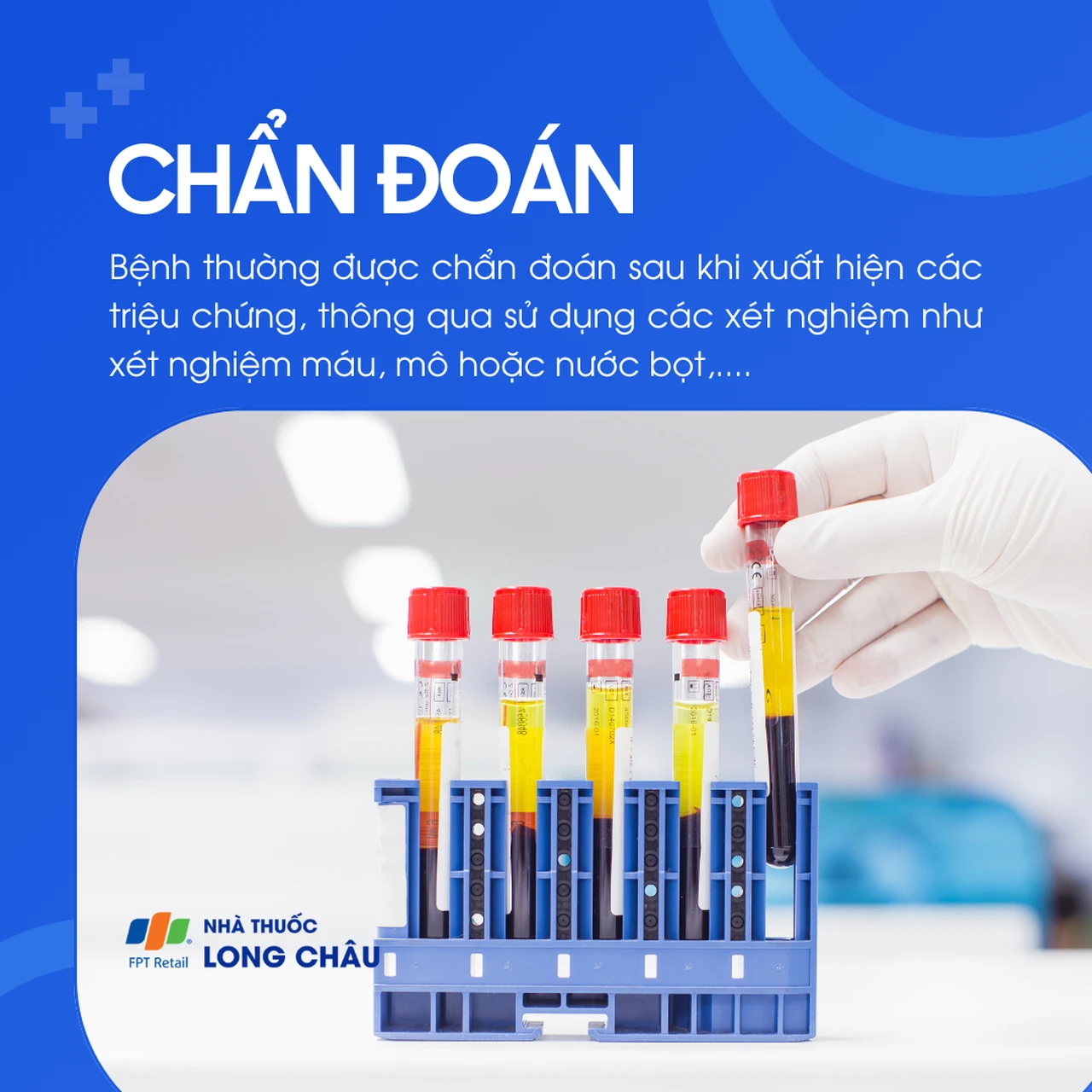 Chẩn đoán bệnh dại qua xét nghiệm máu, mô hoặc nước bọt