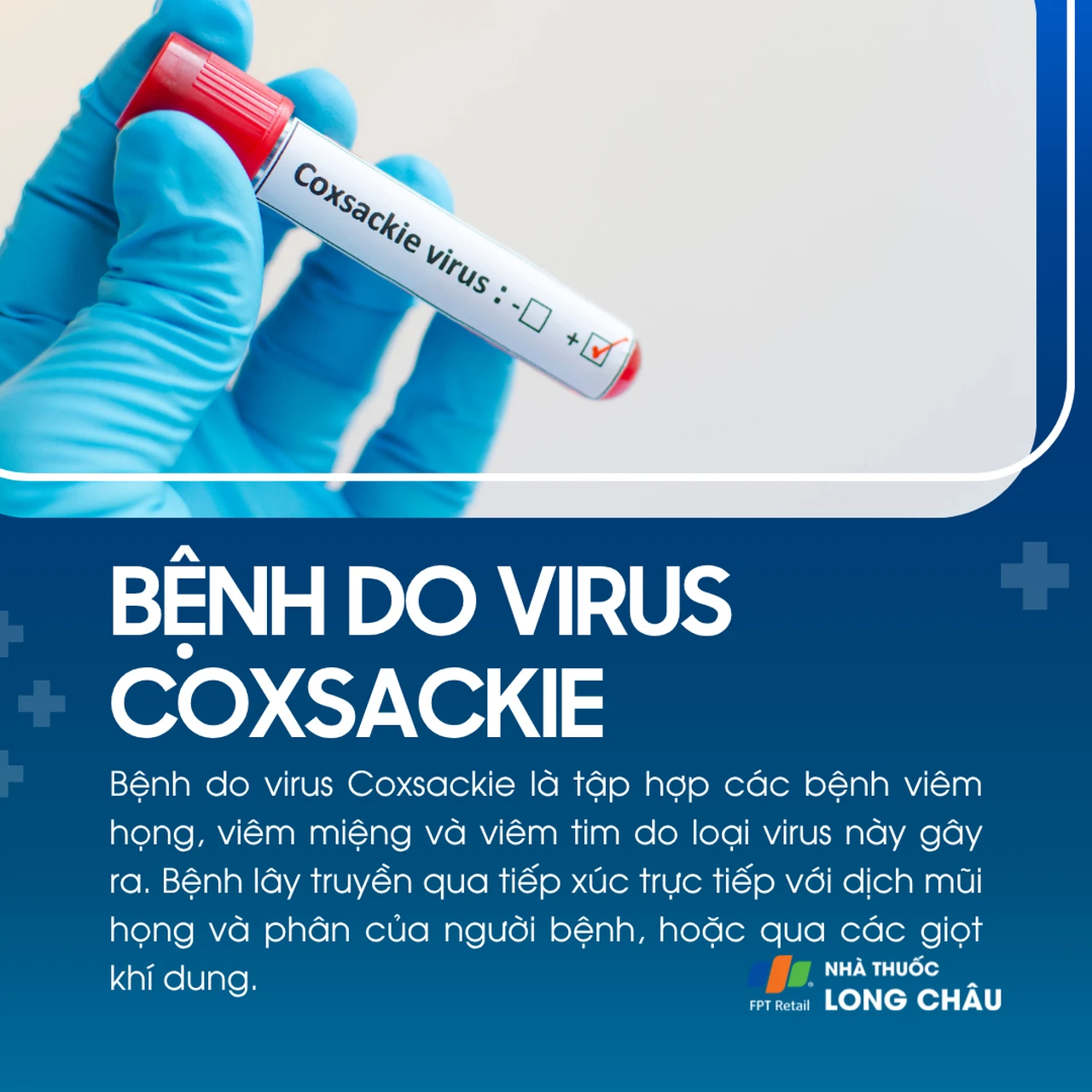 Bệnh do virus Coxsackie 1