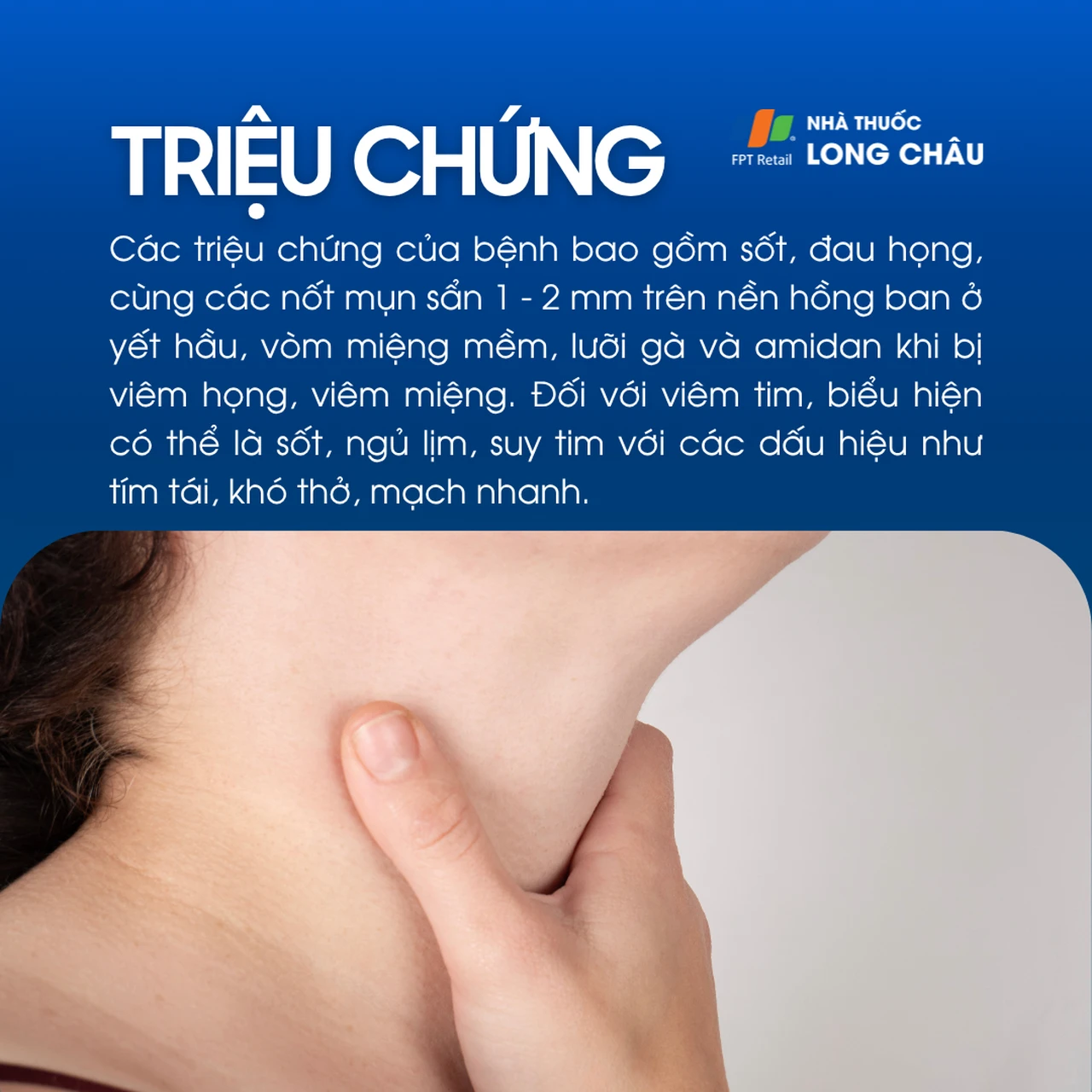 Bệnh do virus Coxsackie 2