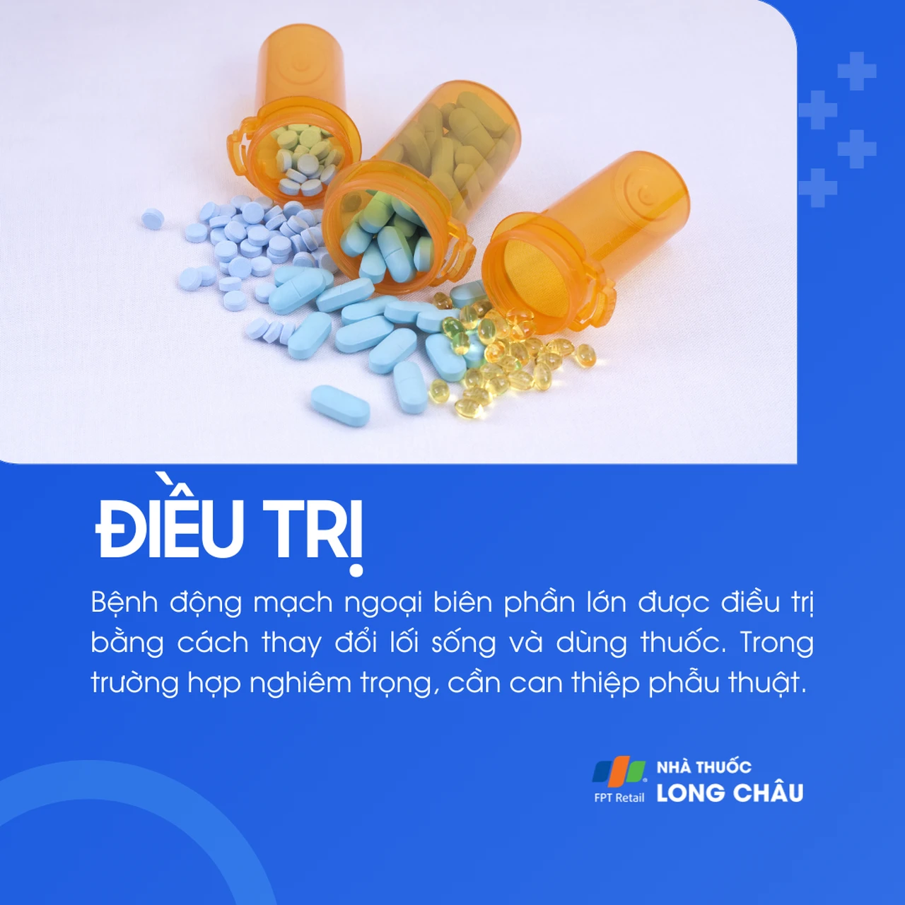 Bệnh động mạch ngoại biên 6