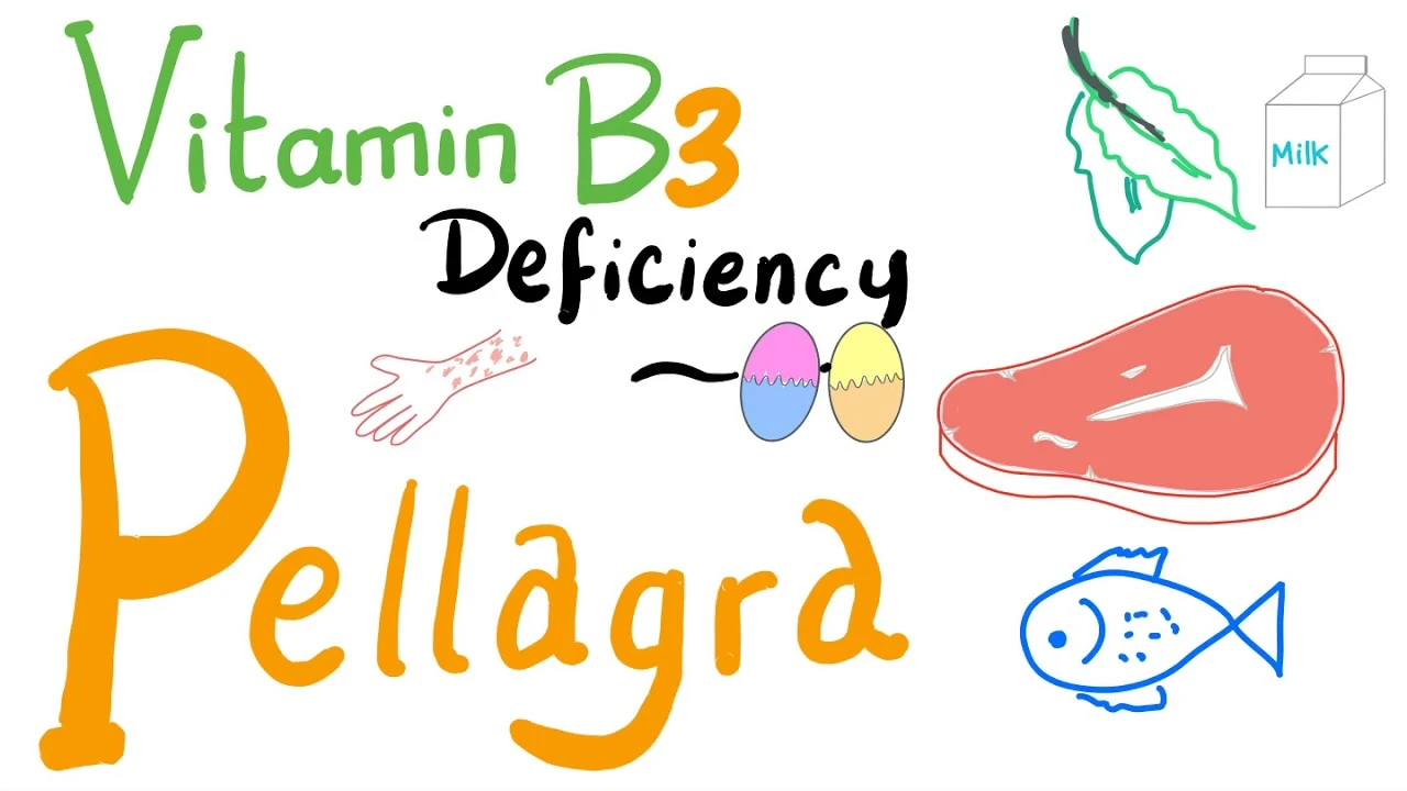 Bệnh Pellagra là bệnh gì? Một số điều cần biết về bệnh Pellagra 1