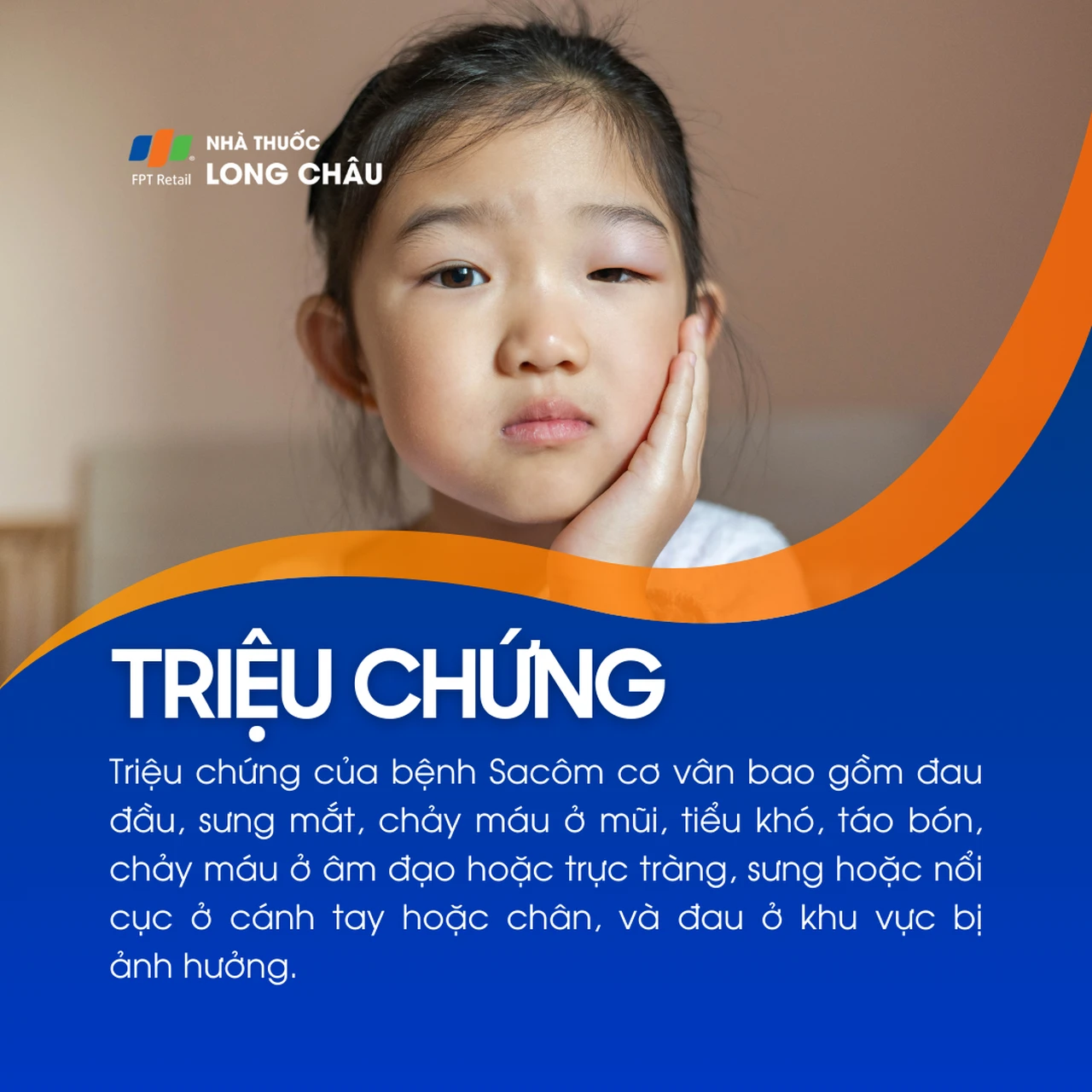 Bệnh Sacôm cơ vân 2