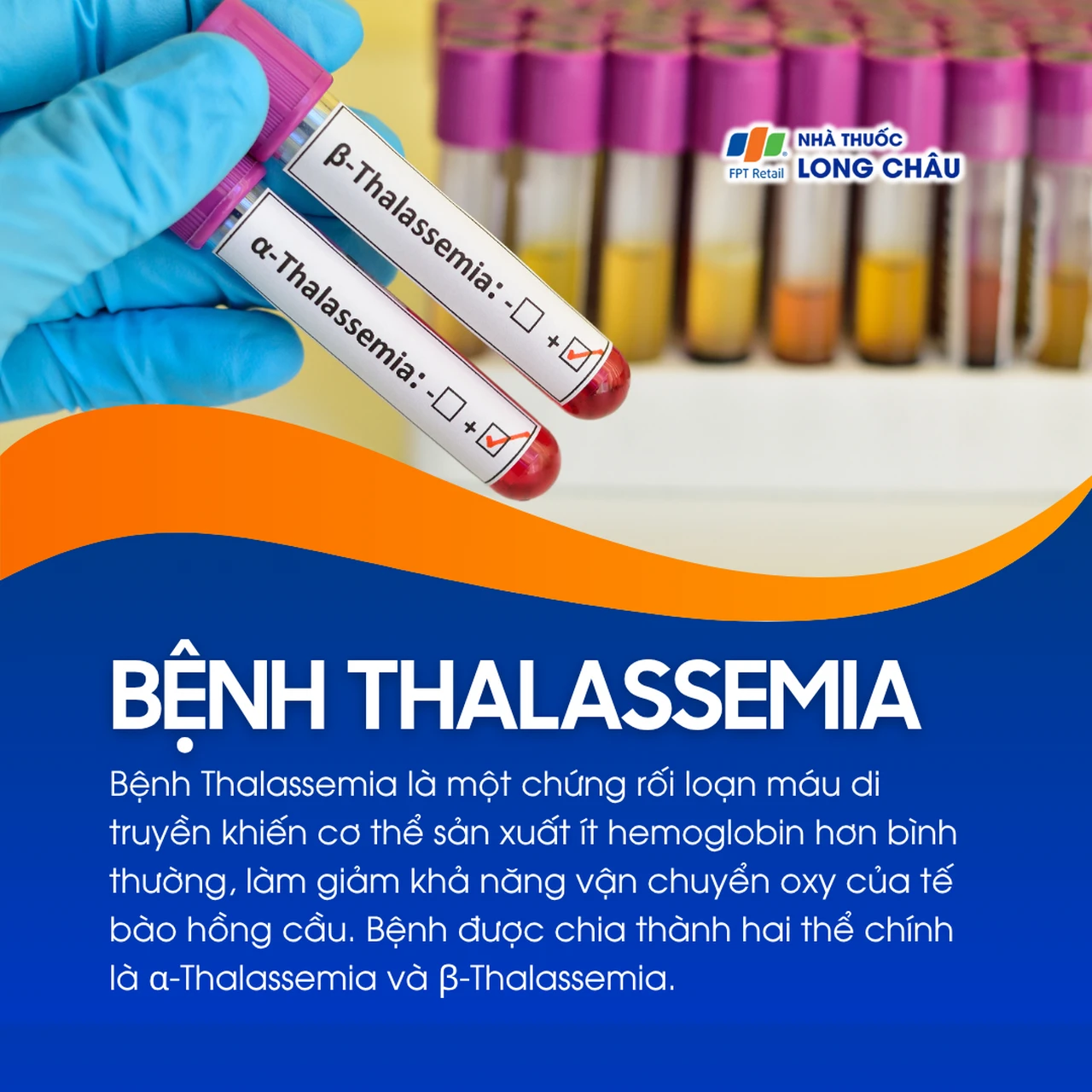 Bệnh Thalassemia 1
