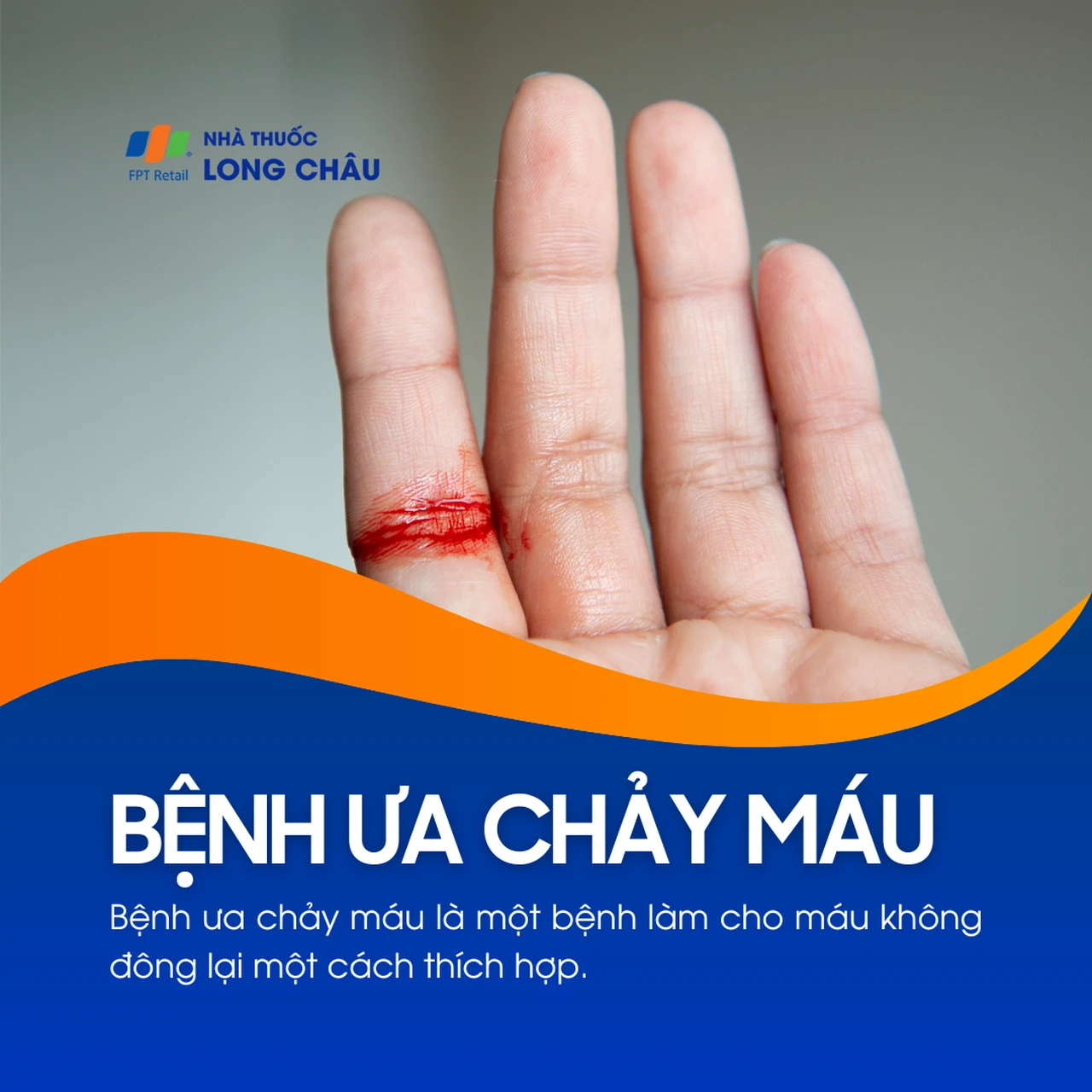 Bệnh ưa chảy máu 1