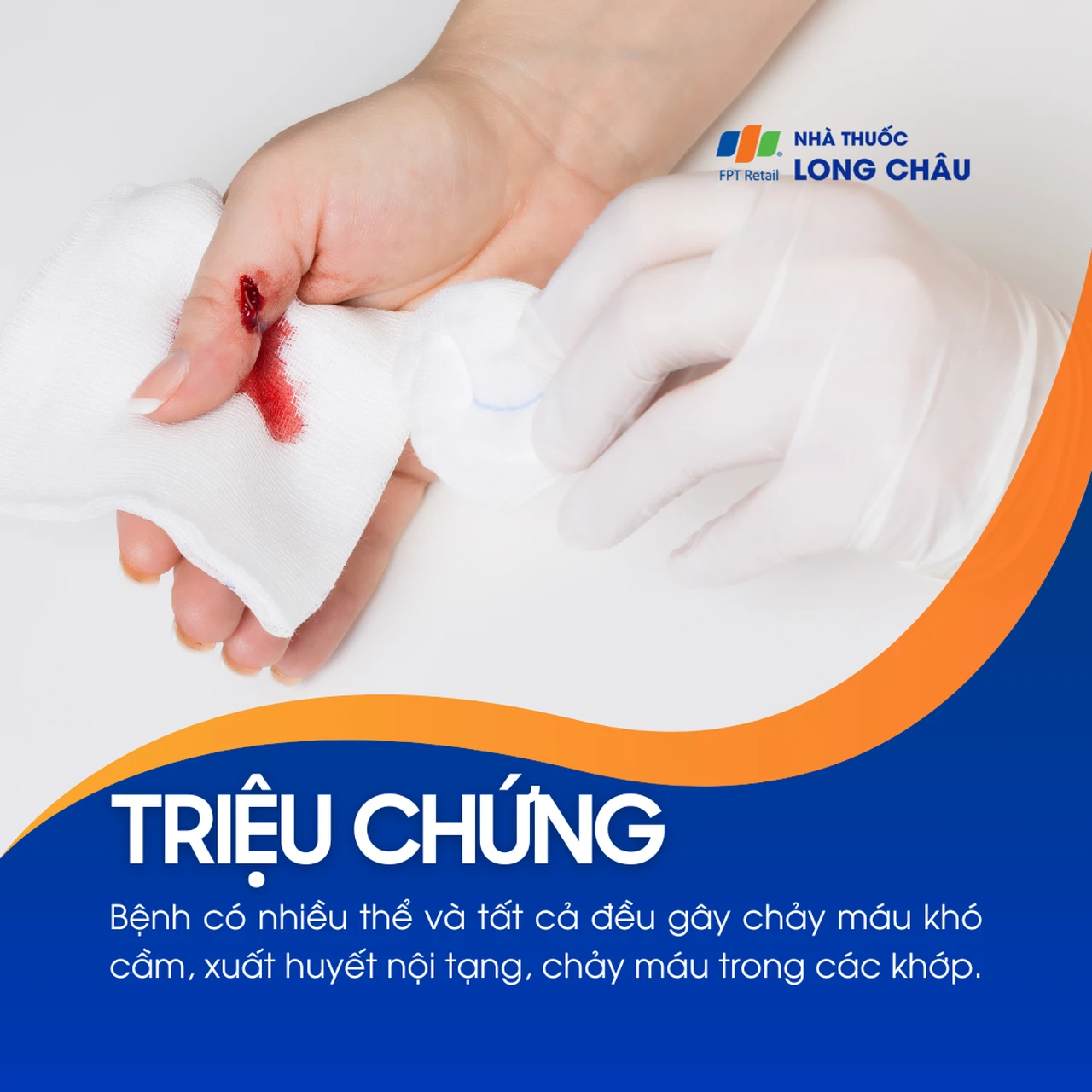 Bệnh ưa chảy máu 2