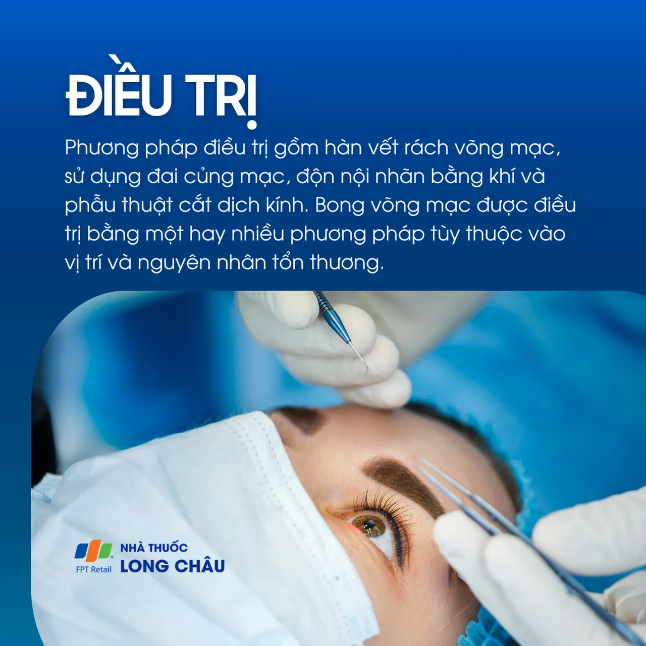 Hàn vết rách, tiêm khí, phẫu thuật cắt dịch kính – tùy nguyên nhân và vị trí tổn thương