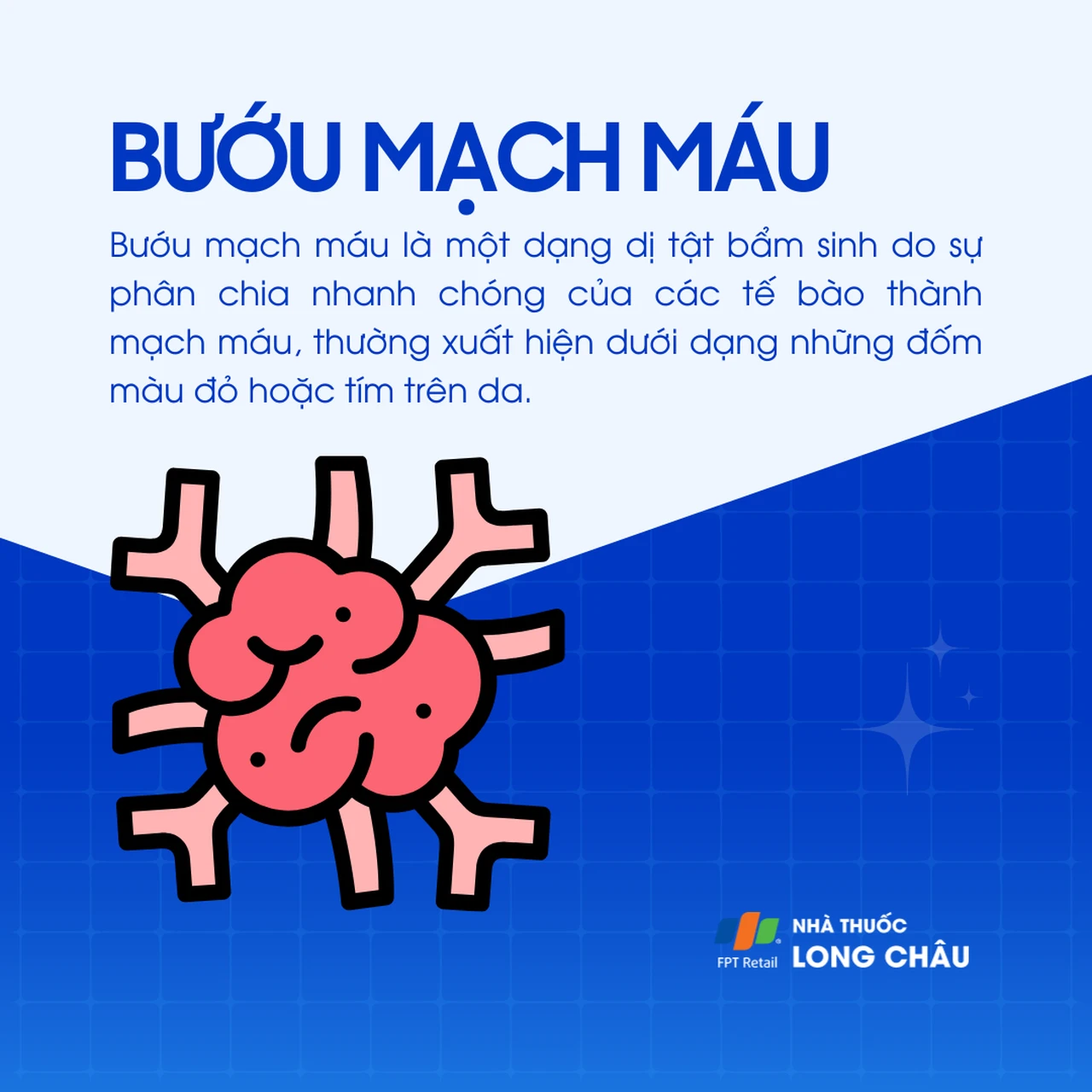 Bướu mạch máu 1