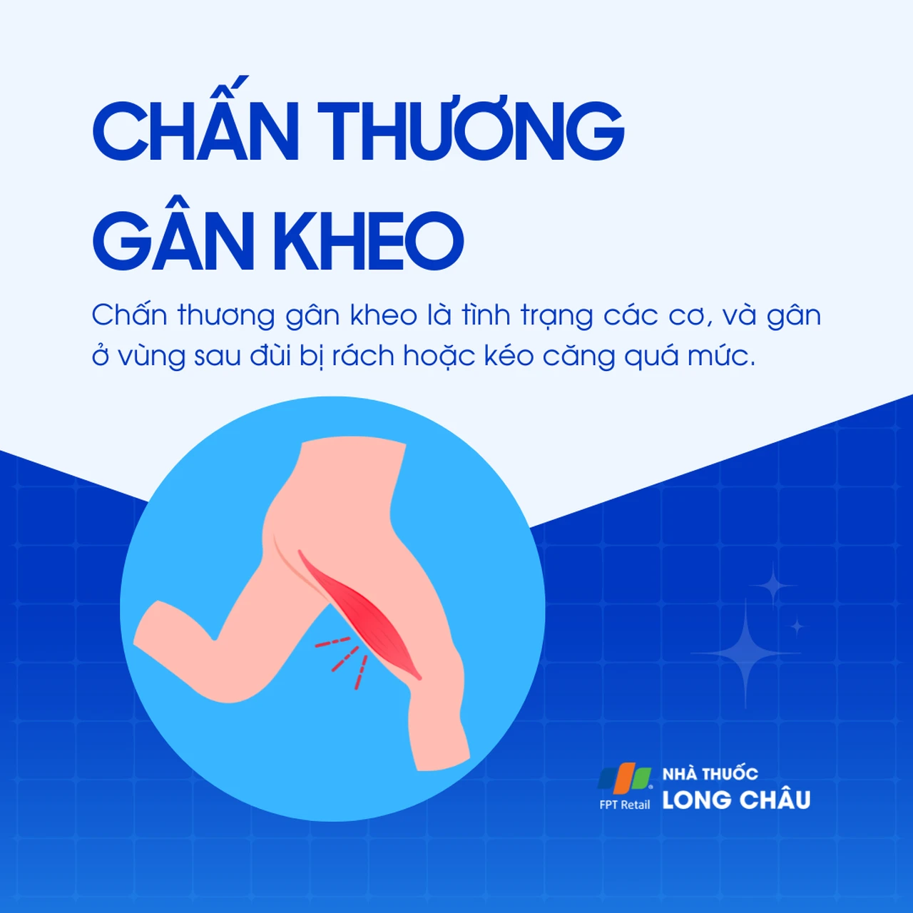 Chấn thương gân kheo 1