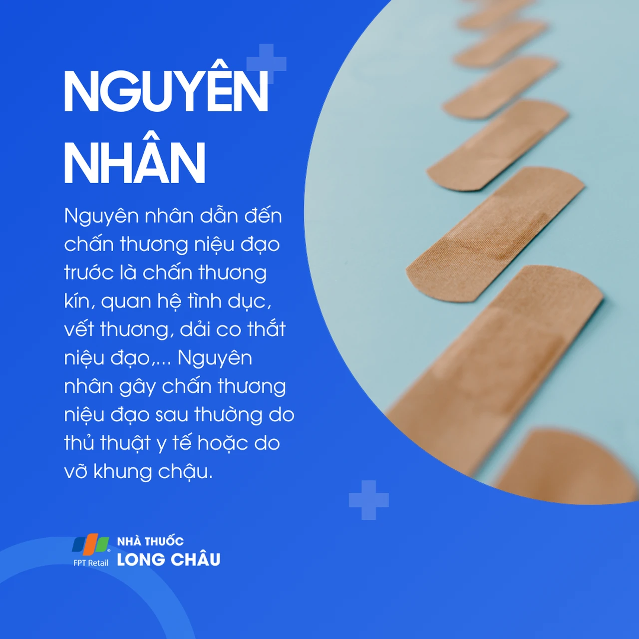 Chấn thương niệu đạo 3