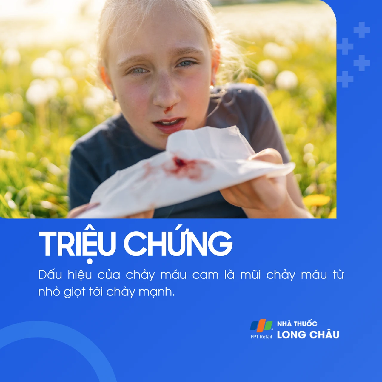 Mũi chảy máu từ nhẹ đến nhiều, đôi khi chảy thành dòng không kiểm soát