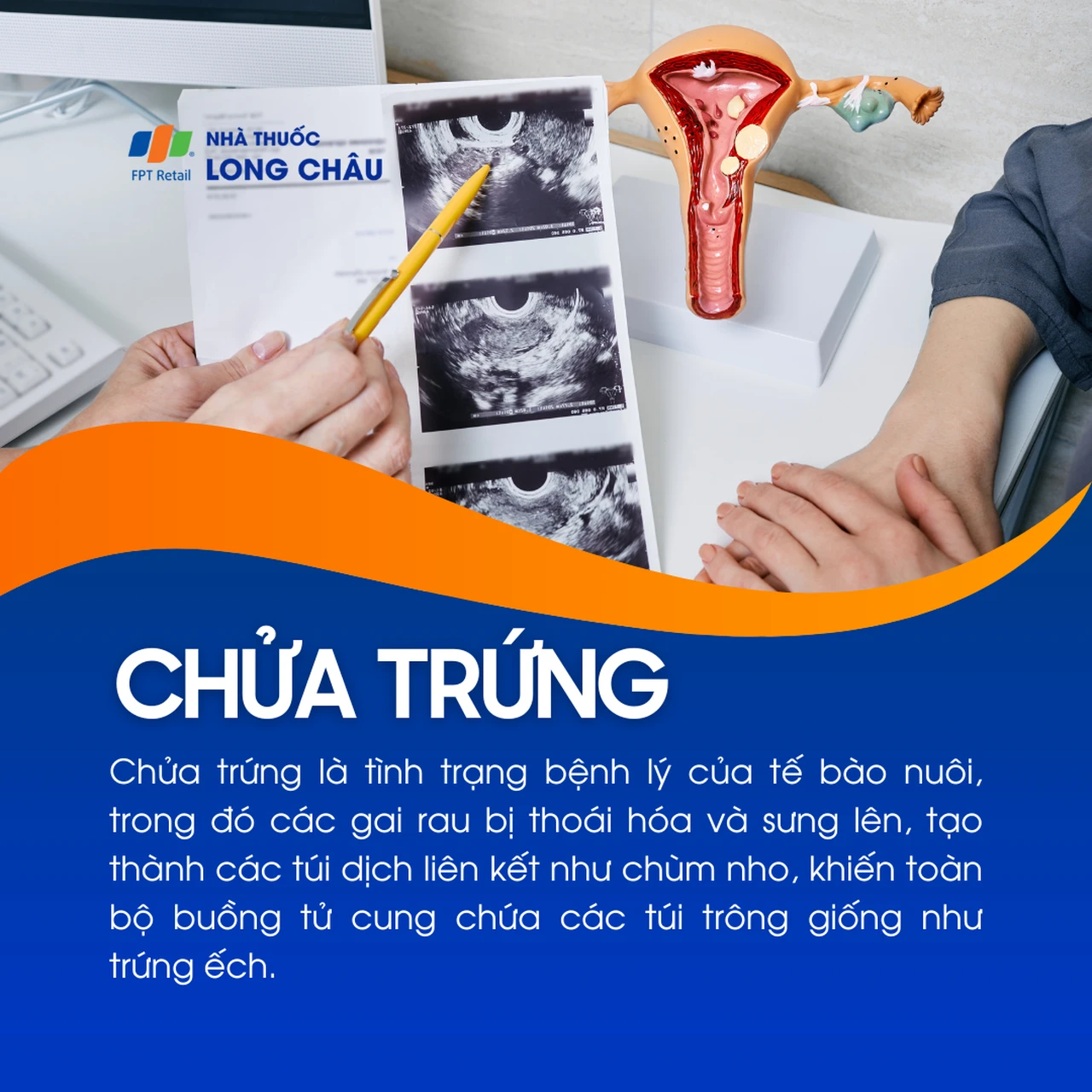 Chửa trứng 1